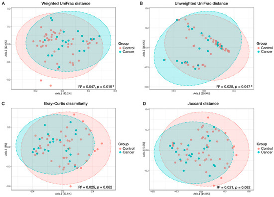 Altered Gastric Microbiota and Inflammatory Cytokine