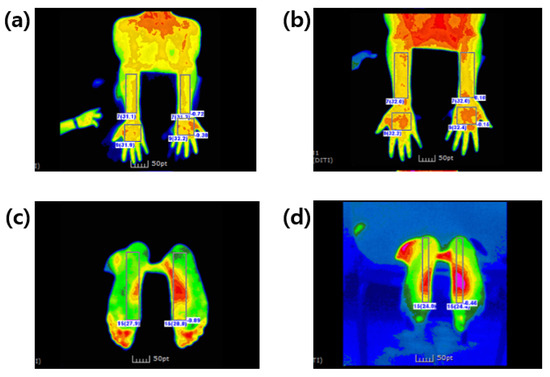 Effects of Fermented Garlic Extract Containing Nitric Oxide