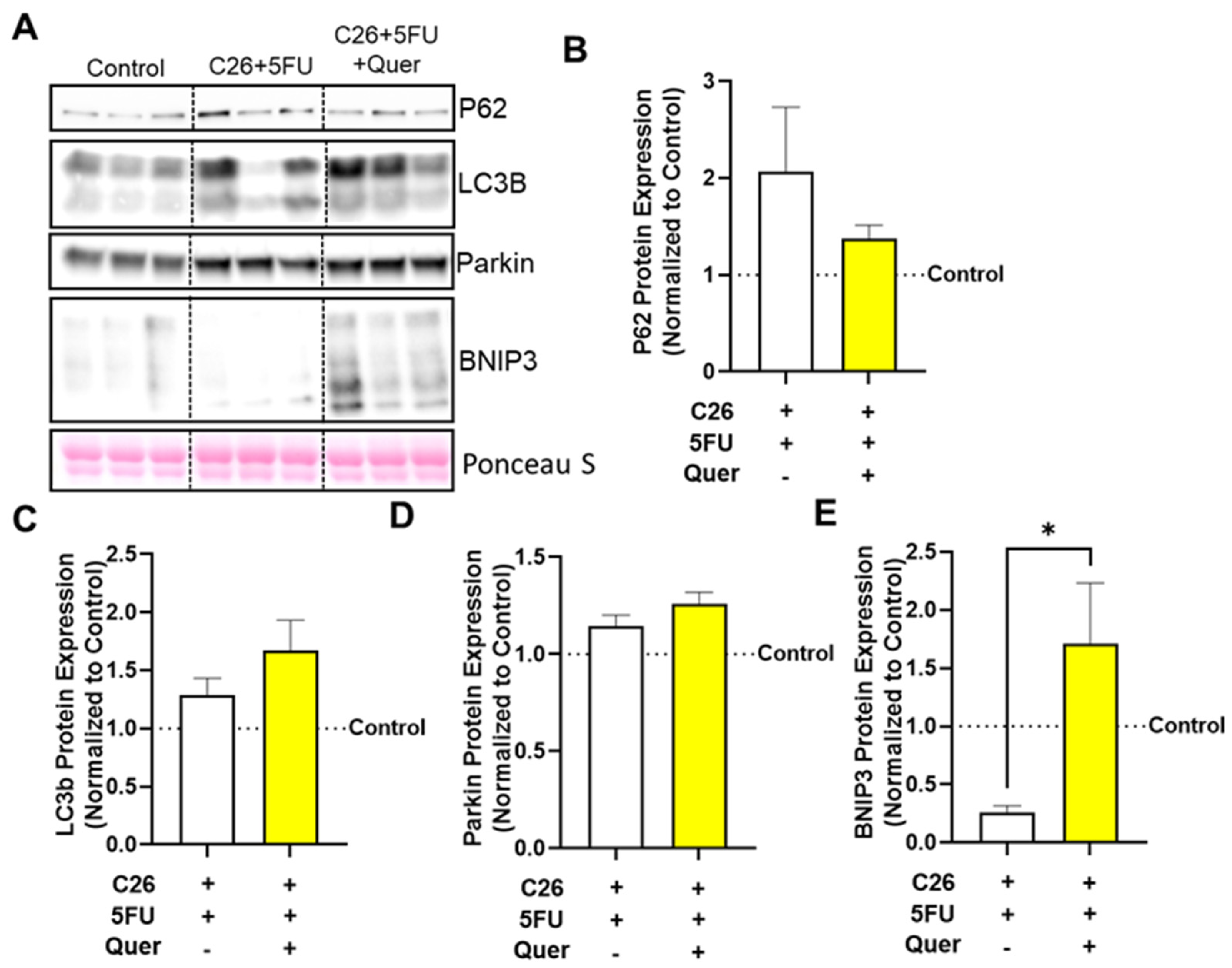 Nutrients 15 00102 g005 Nutrients 15 00102 g005