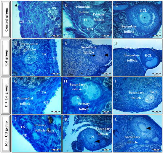 公式写真Ｅ HINATA XG 2nd Mini Album AWE 2024.11.08 FRI #XG #AWE #XG_AWE