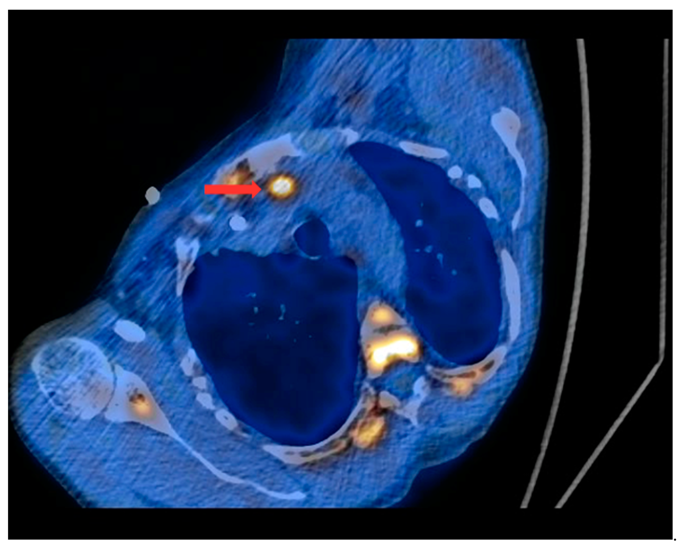 Nutrients 15 00188 g004