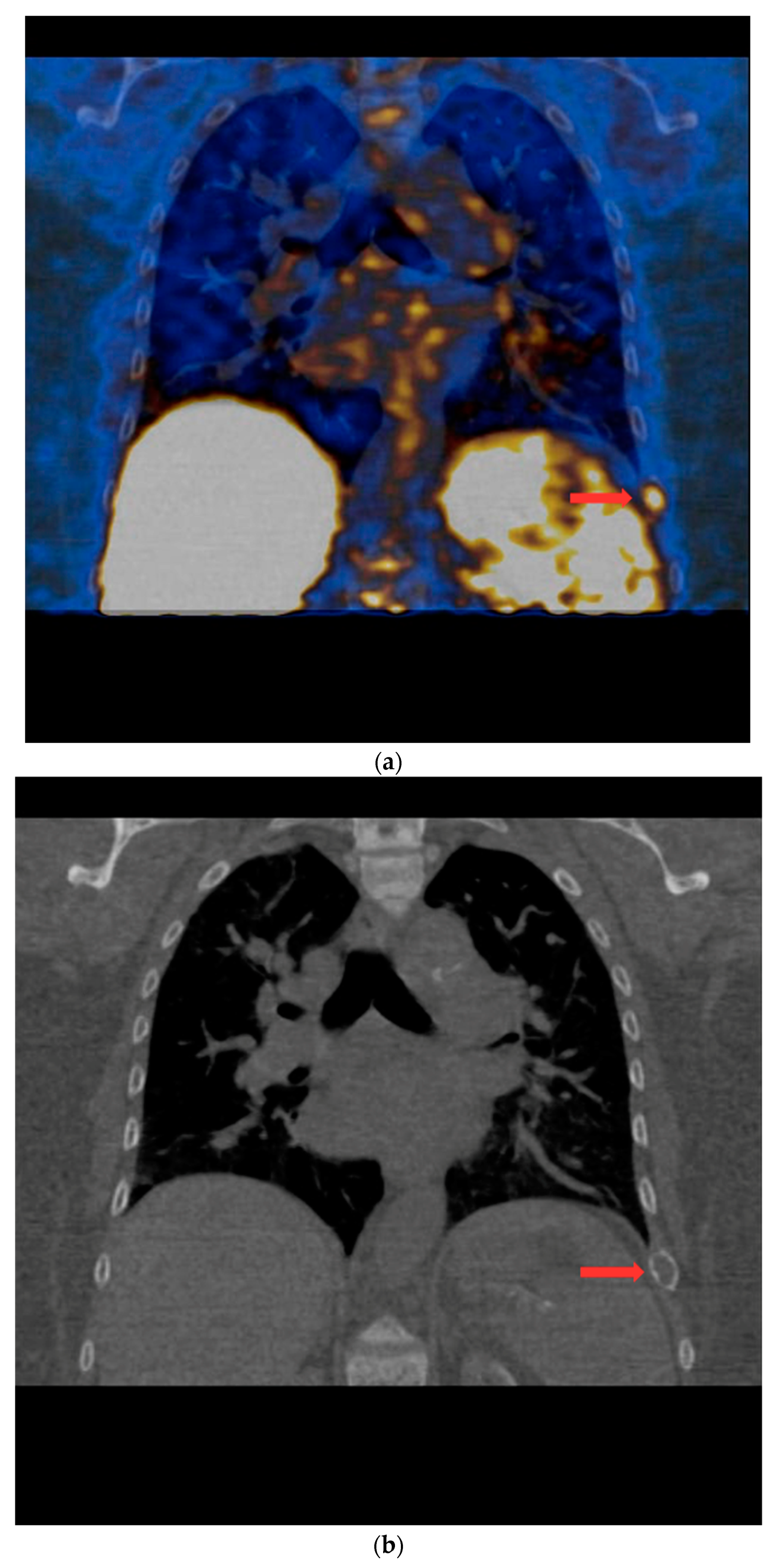Nutrients 15 00188 g005