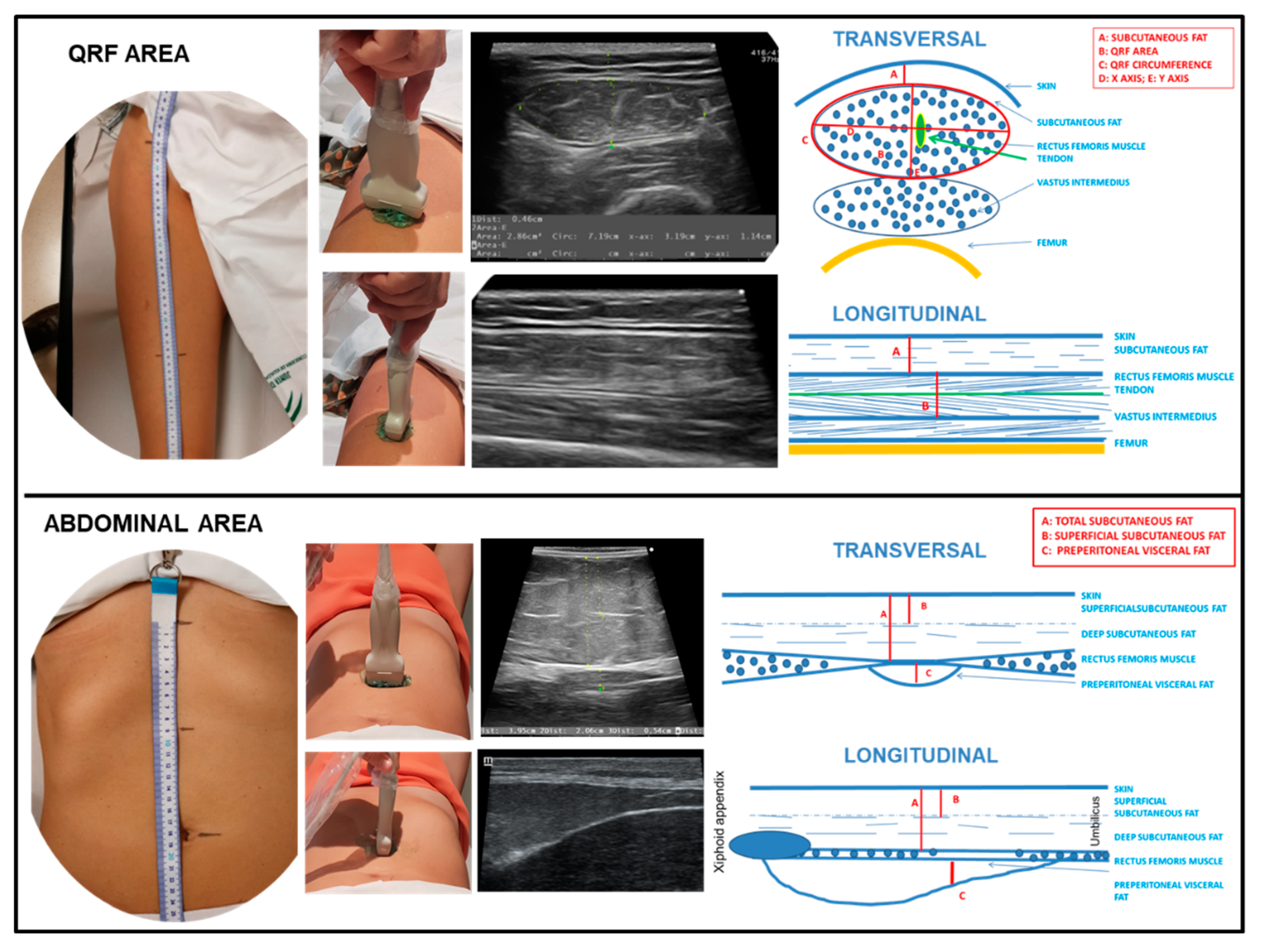 Nutrients 15 00522 g002 Nutrients 15 00522 g002