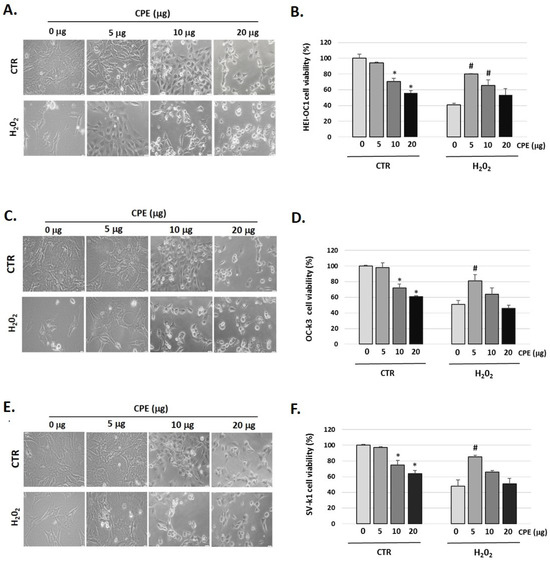 Nutrients Free FullText Cocoa Polyphenol Extract Inhibits Cellular