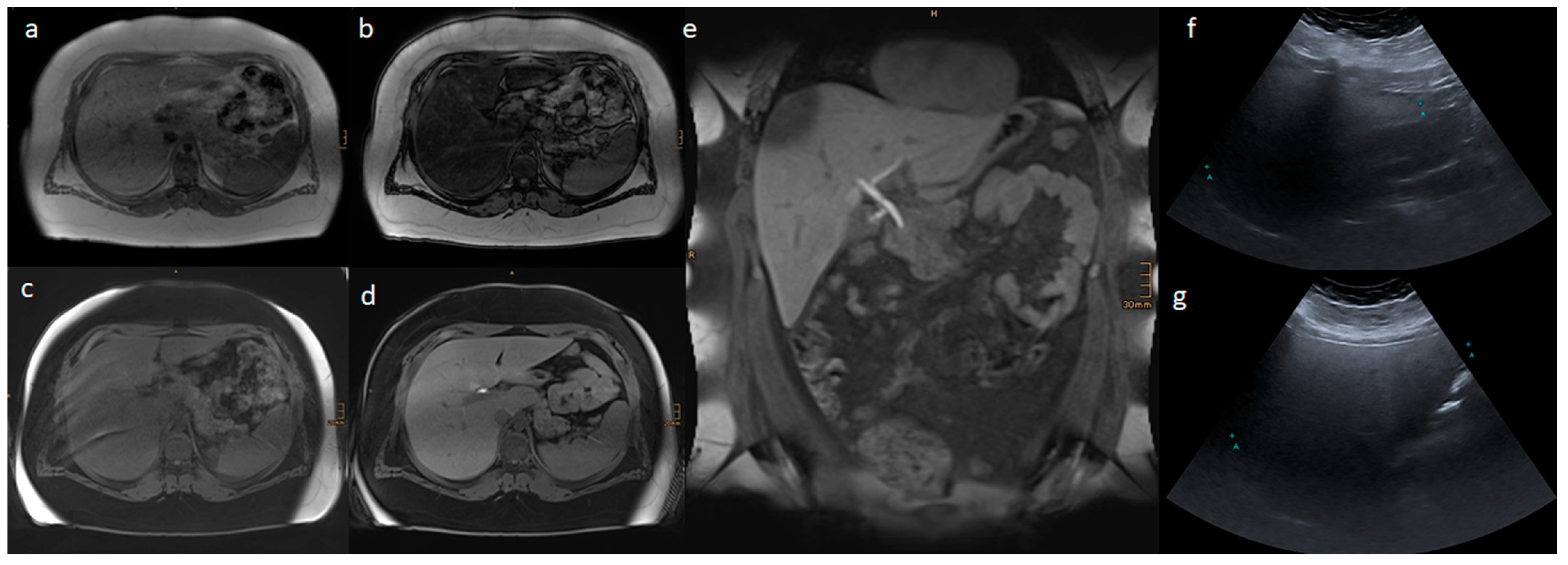 Nutrients 15 00558 g002 Nutrients 15 00558 g002