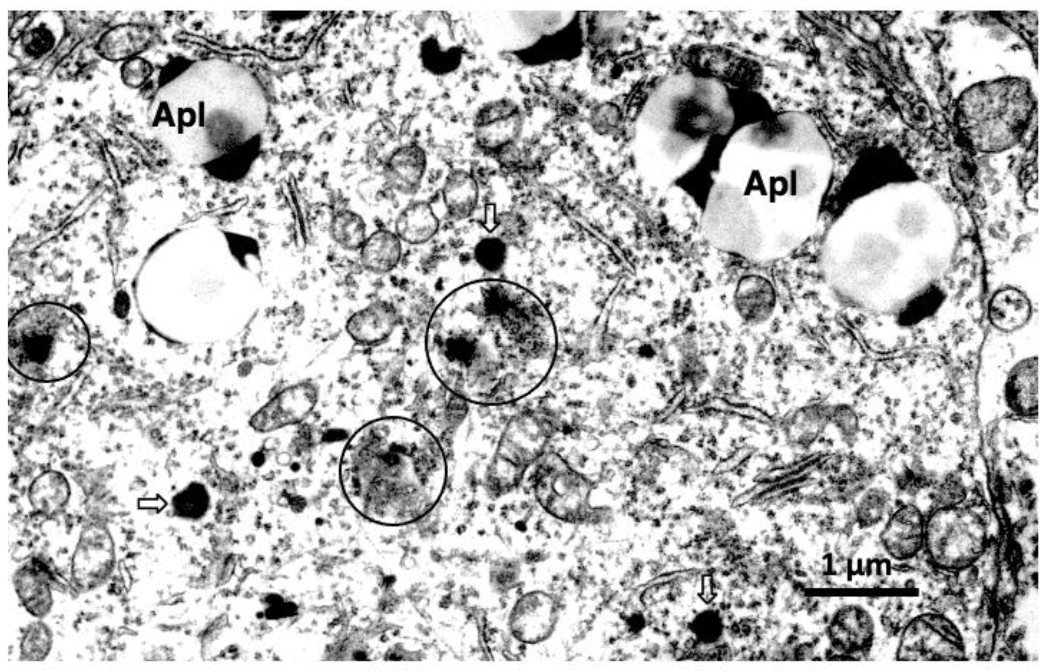 Nutrients 15 00609 g007 Nutrients 15 00609 g007