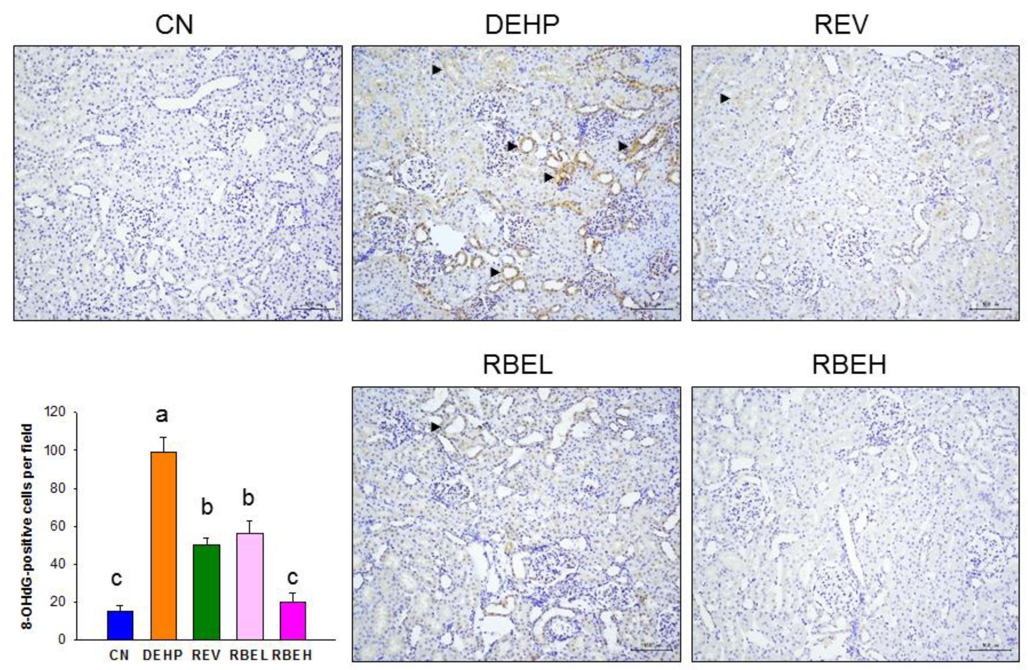 Nutrients 15 00697 g003 Nutrients 15 00697 g003