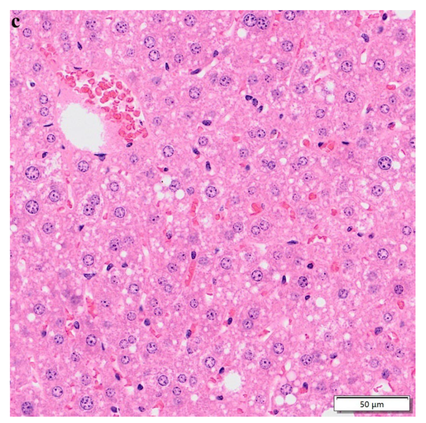 Nutrients 15 00948 g007b
