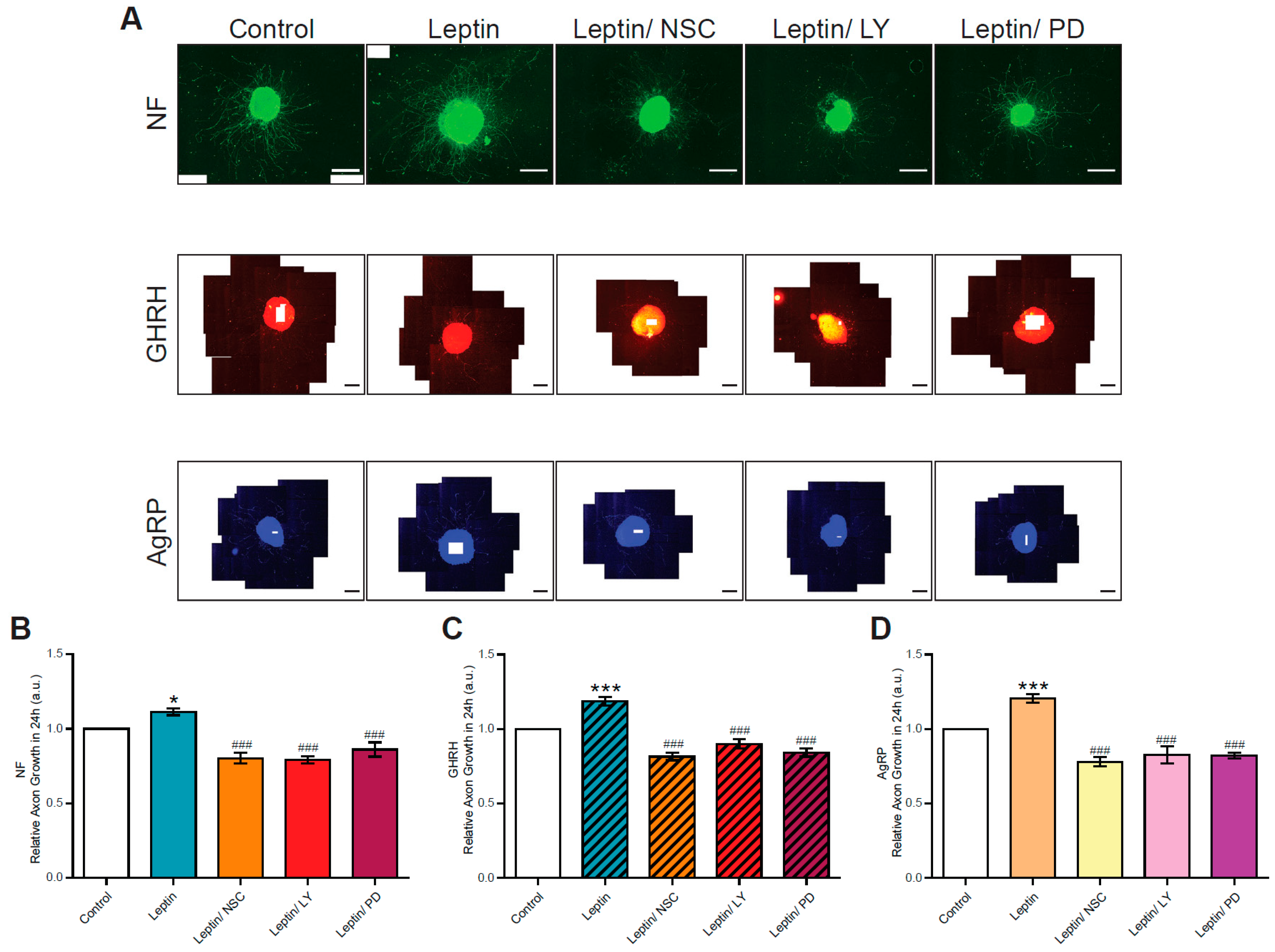 Nutrients 15 01077 g003 Nutrients 15 01077 g003