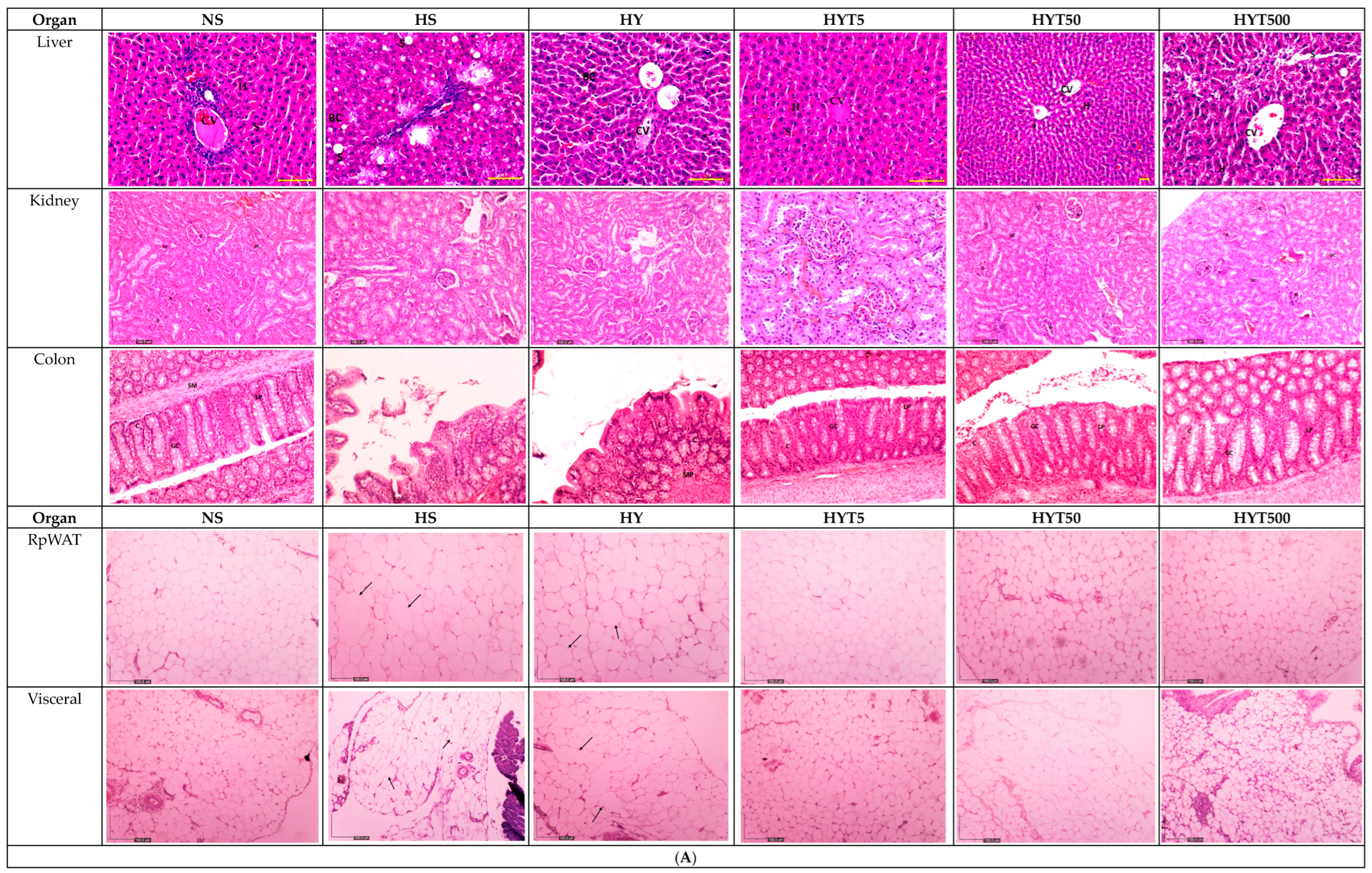 Nutrients 15 01258 g003a Nutrients 15 01258 g003a