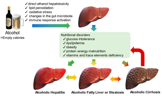 Nutrients Free Full Text Nutritional Support For Alcoholic Liver 