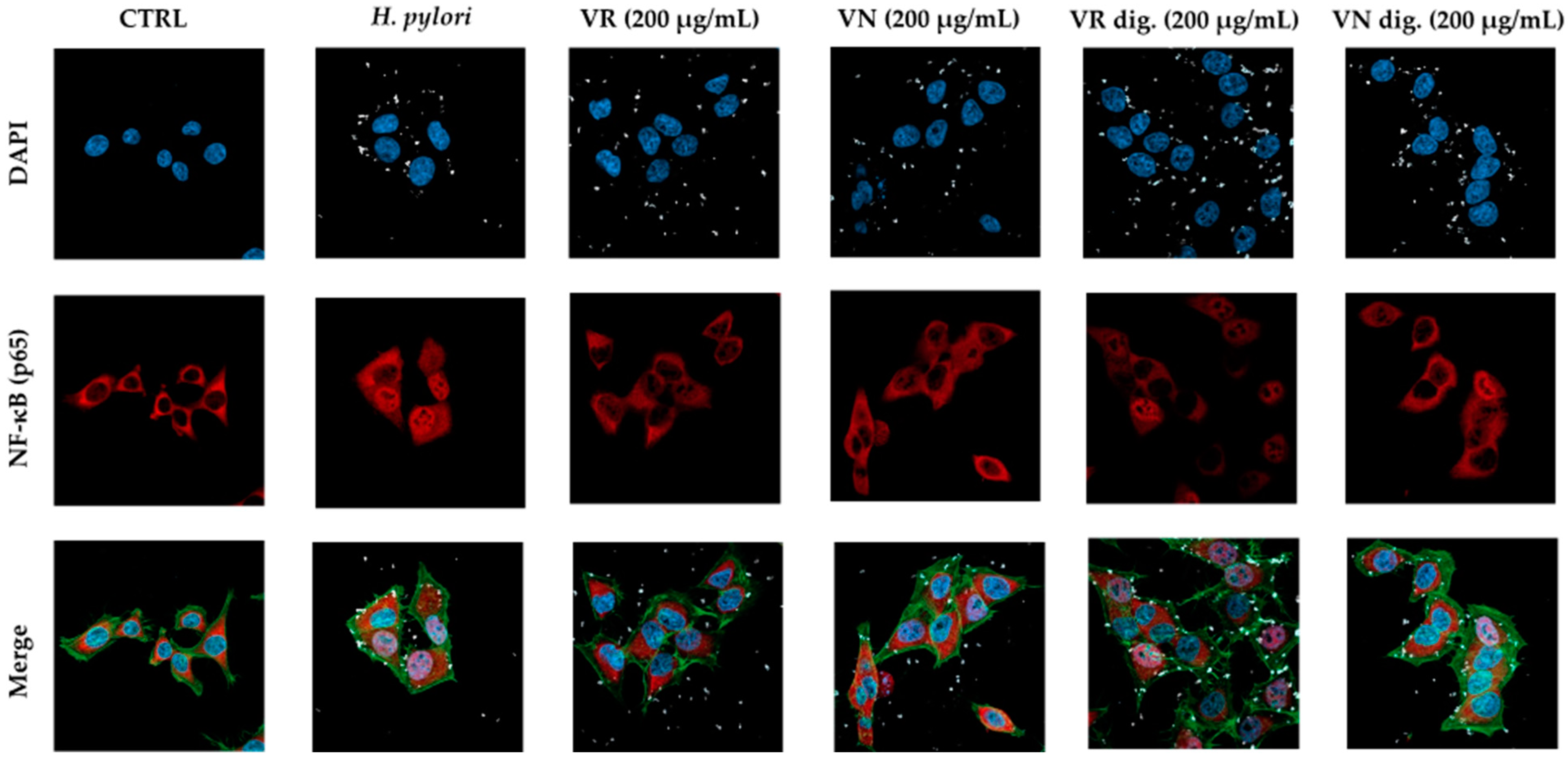 Nutrients 15 01504 g004