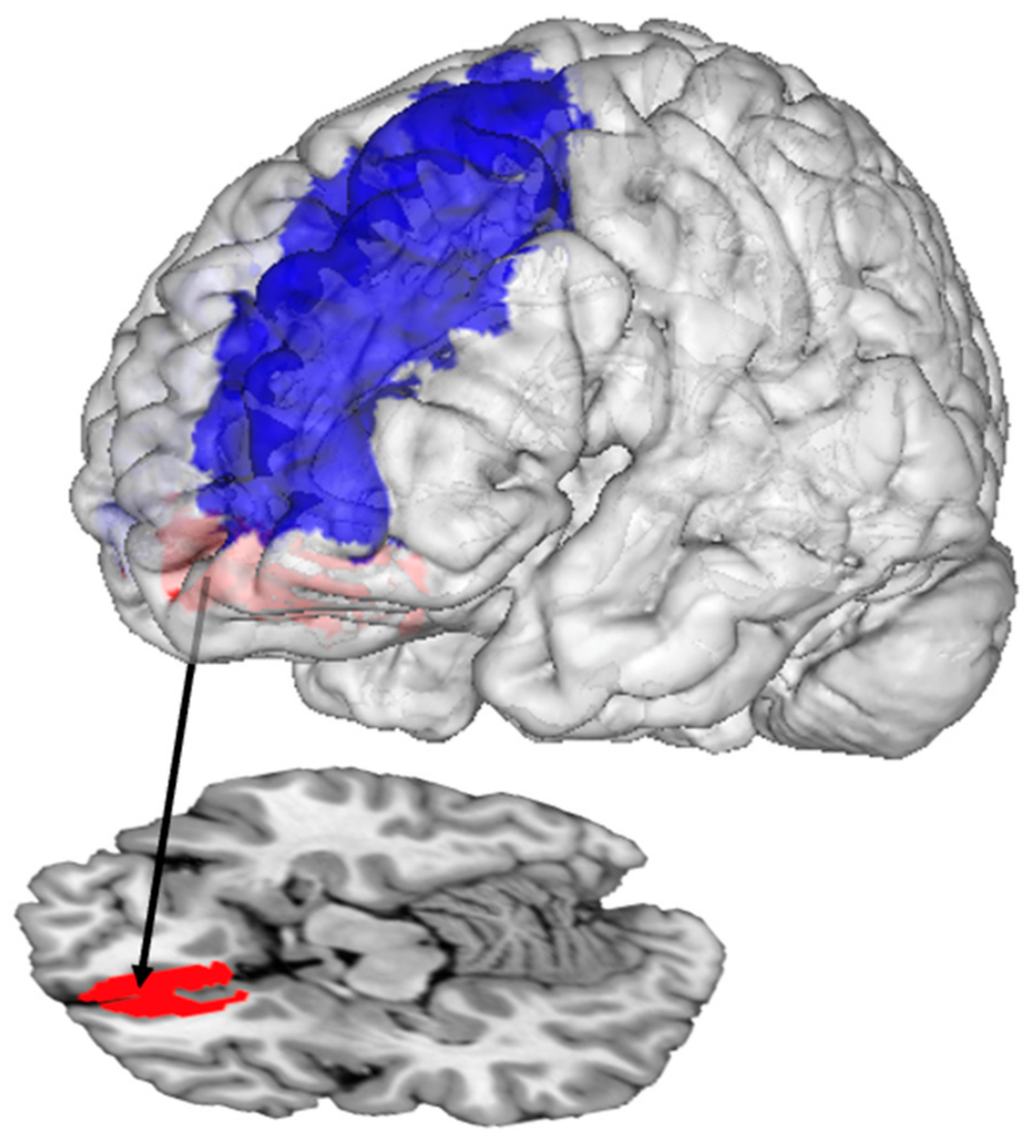 Nutrients 15 01577 g004 Nutrients 15 01577 g004