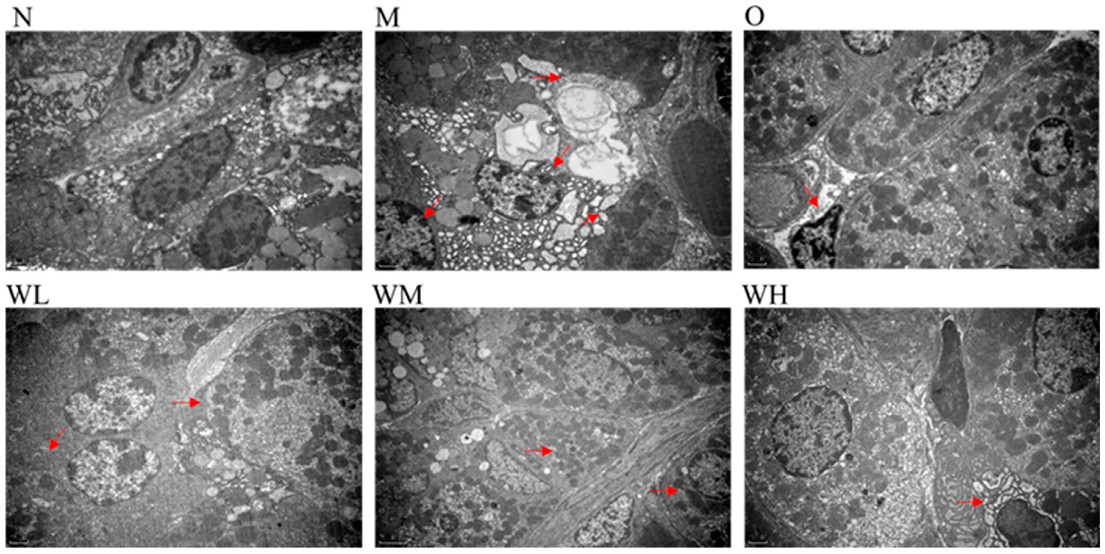 Nutrients 15 01675 g002 Nutrients 15 01675 g002