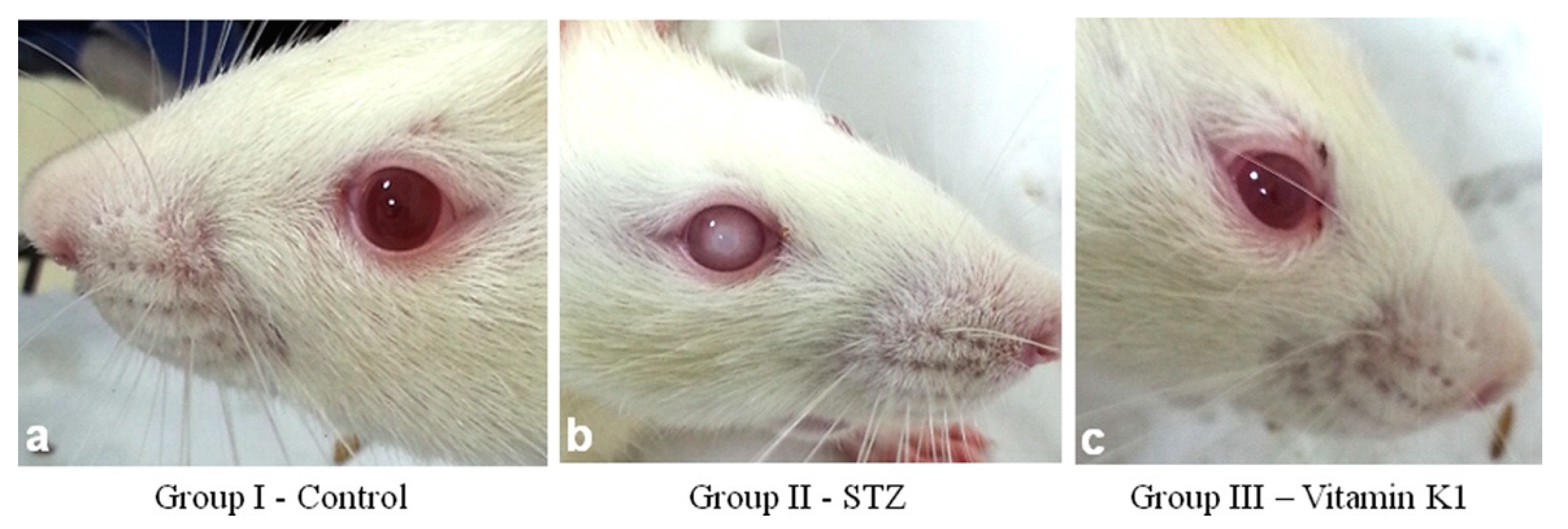 Nutrients 15 01948 g004 Nutrients 15 01948 g004