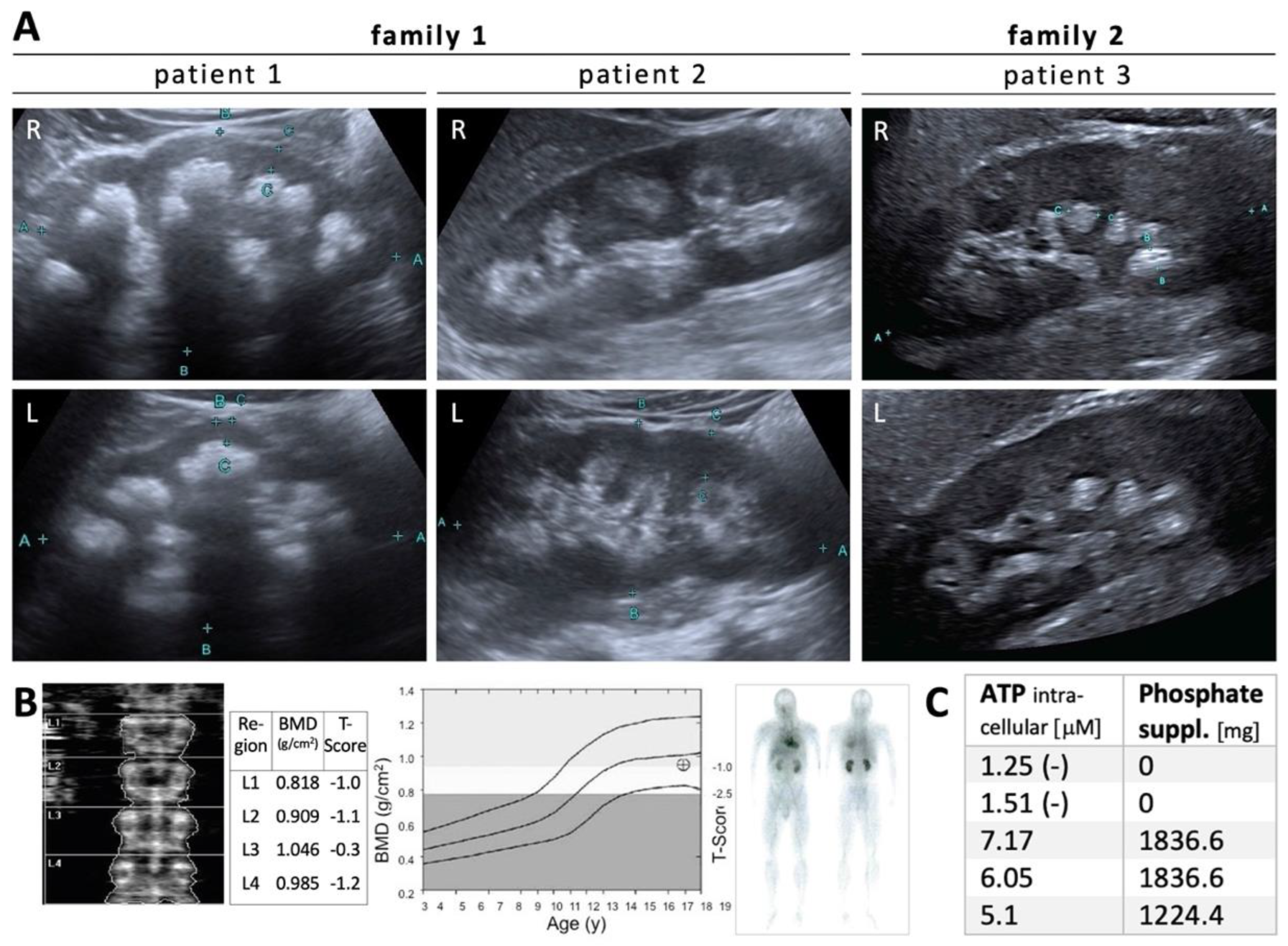 Nutrients 15 02081 g001 Nutrients 15 02081 g001