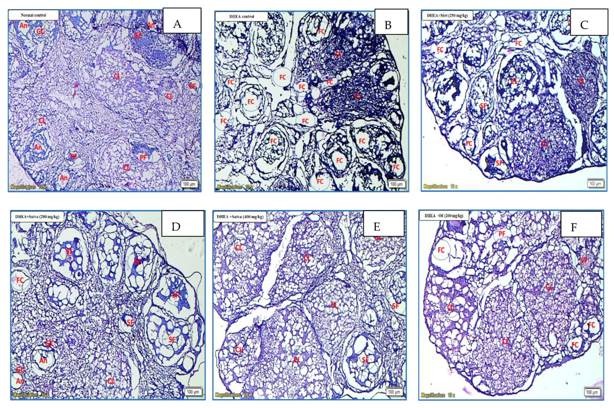Nutrients 15 02238 g008a Nutrients 15 02238 g008a