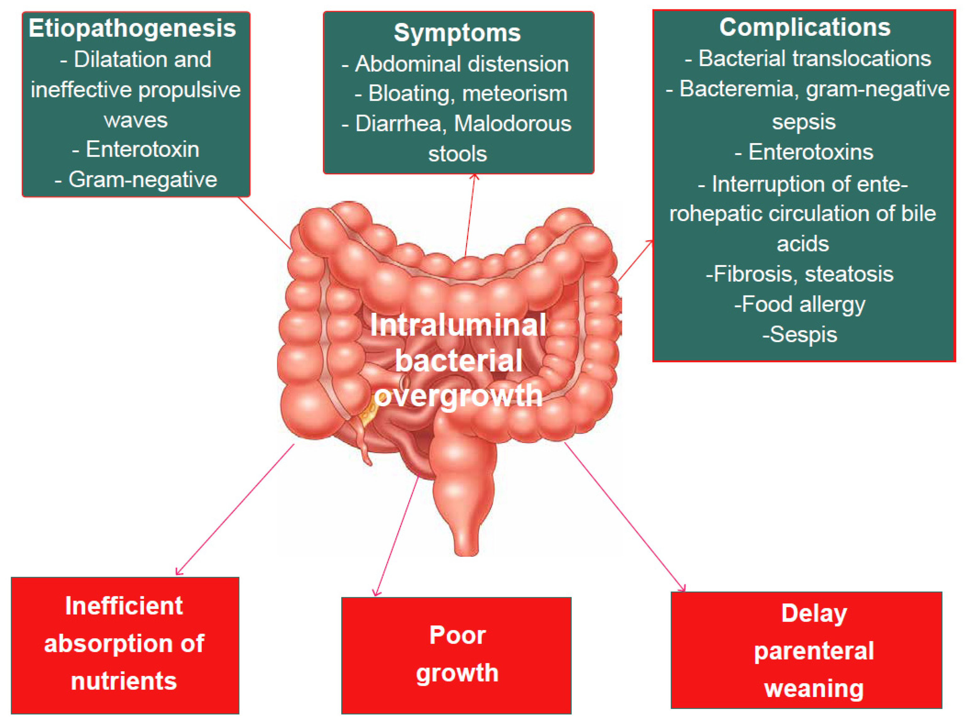 Nutrients Free FullText An Overview of ShortBowel Syndrome in
