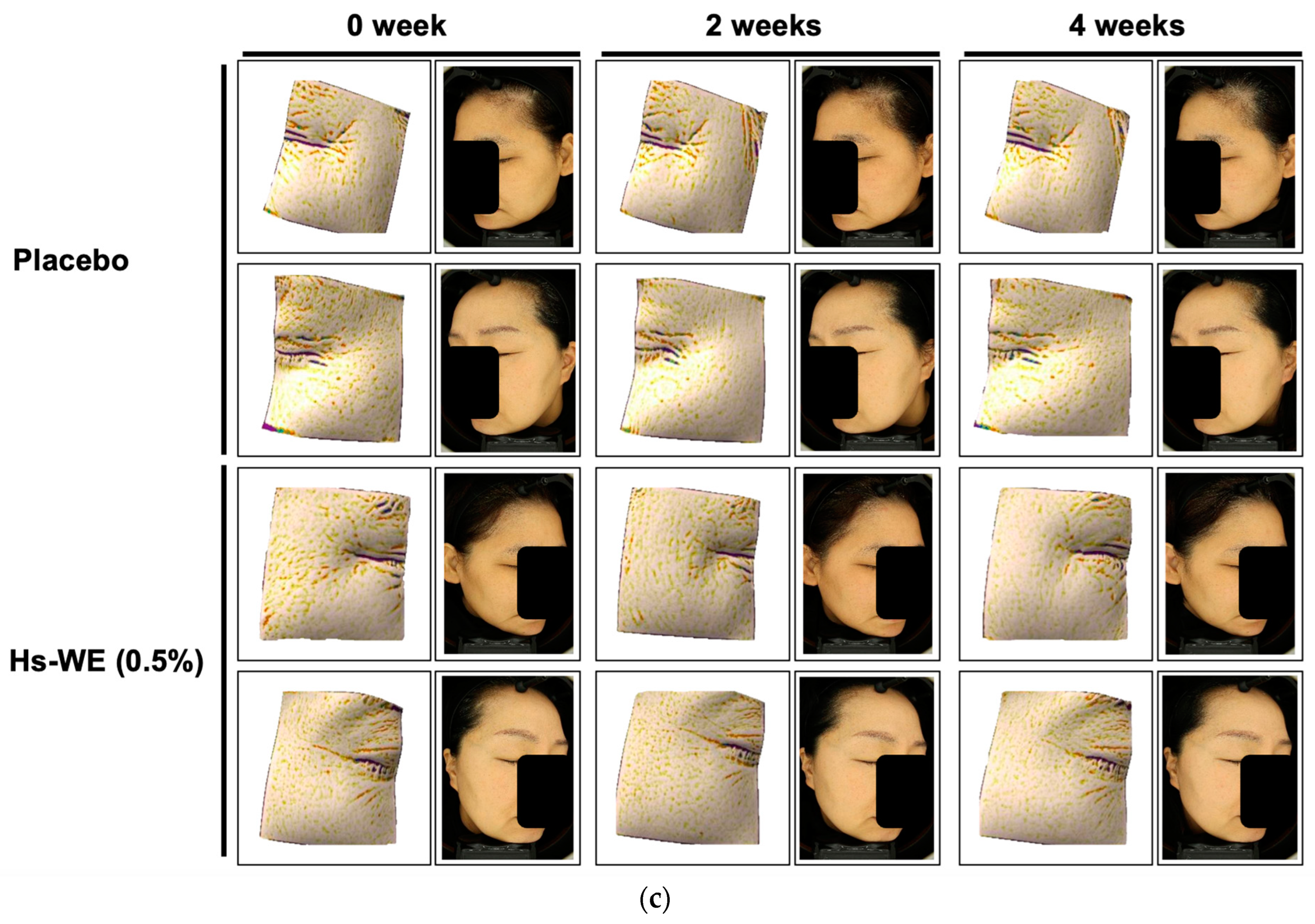 Nutrients 15 02436 g001b