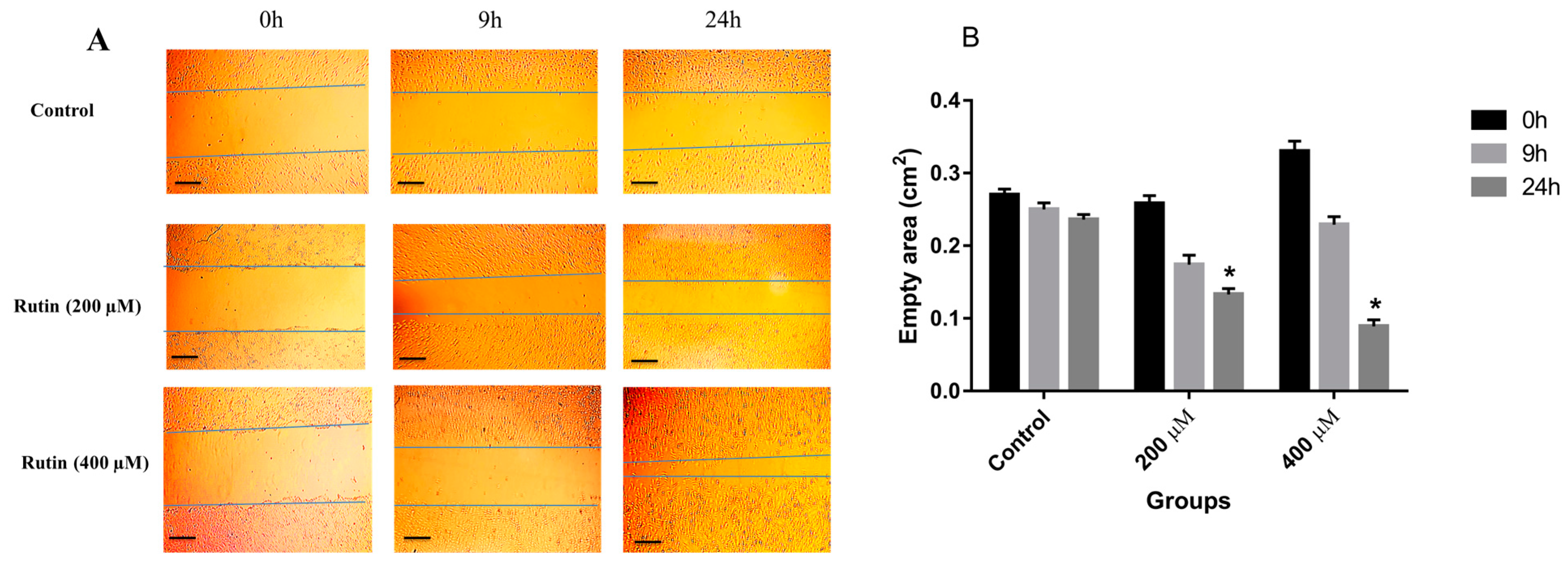 Nutrients 15 02884 g003 Nutrients 15 02884 g003
