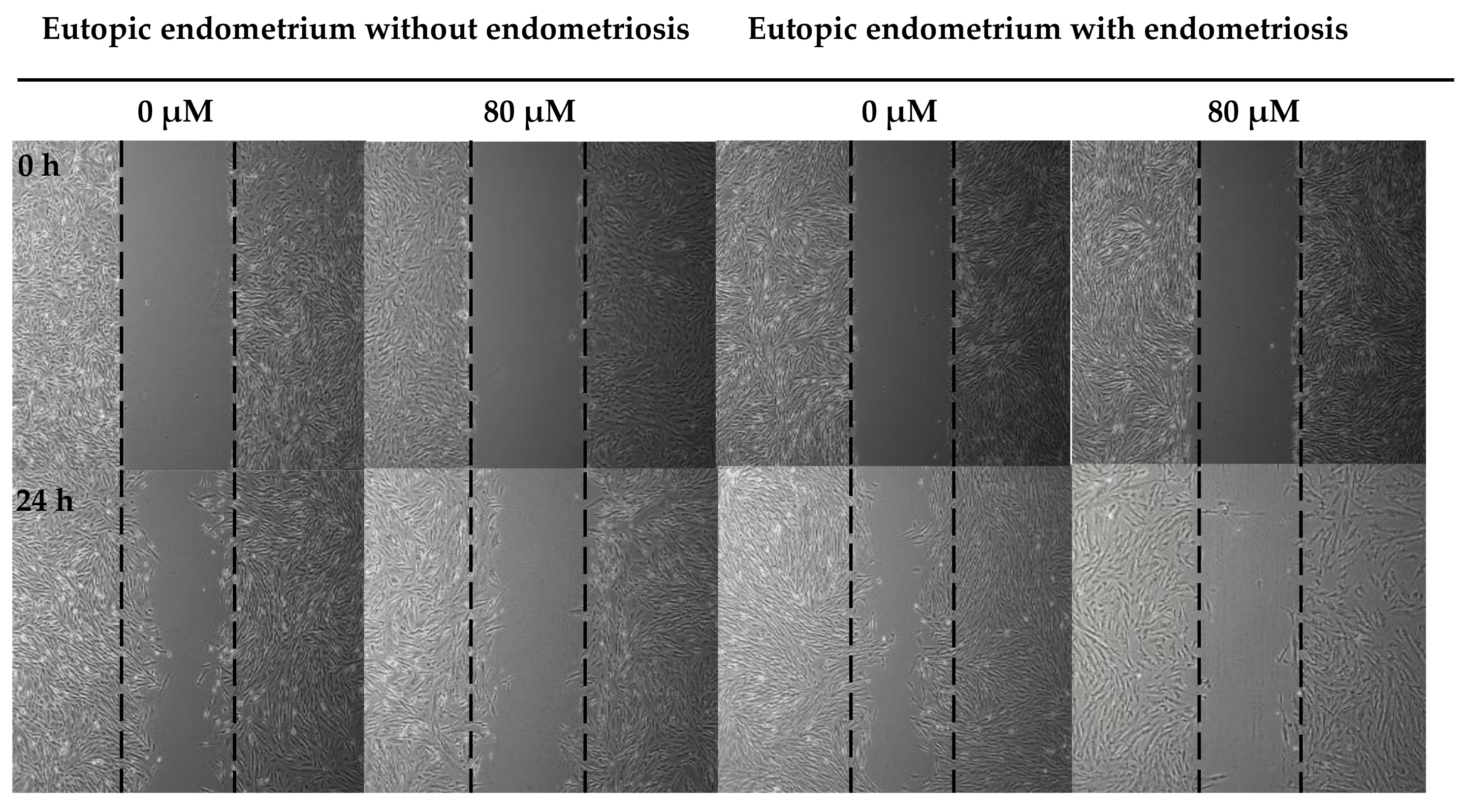 Nutrients 15 03001 g004a Nutrients 15 03001 g004a