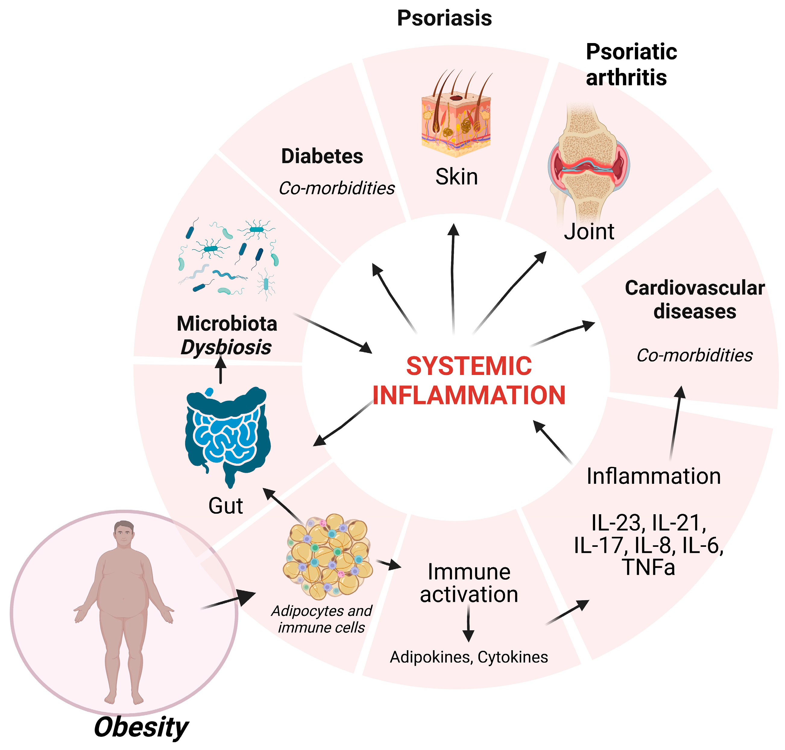 Why Weight Loss Is Key in Osteoarthritis Management