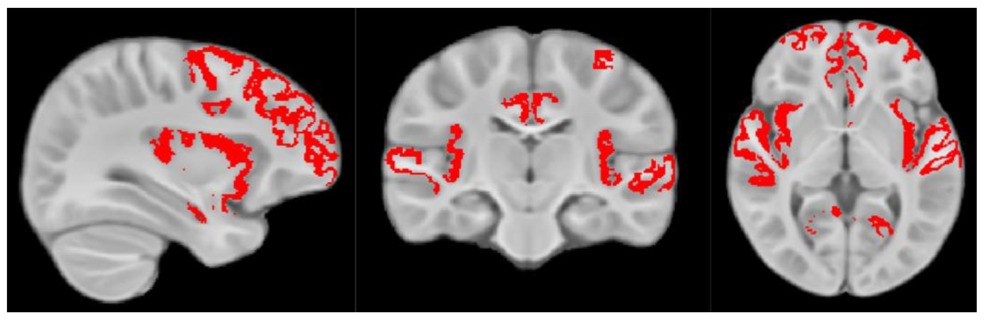 Nutrients 15 03754 g001