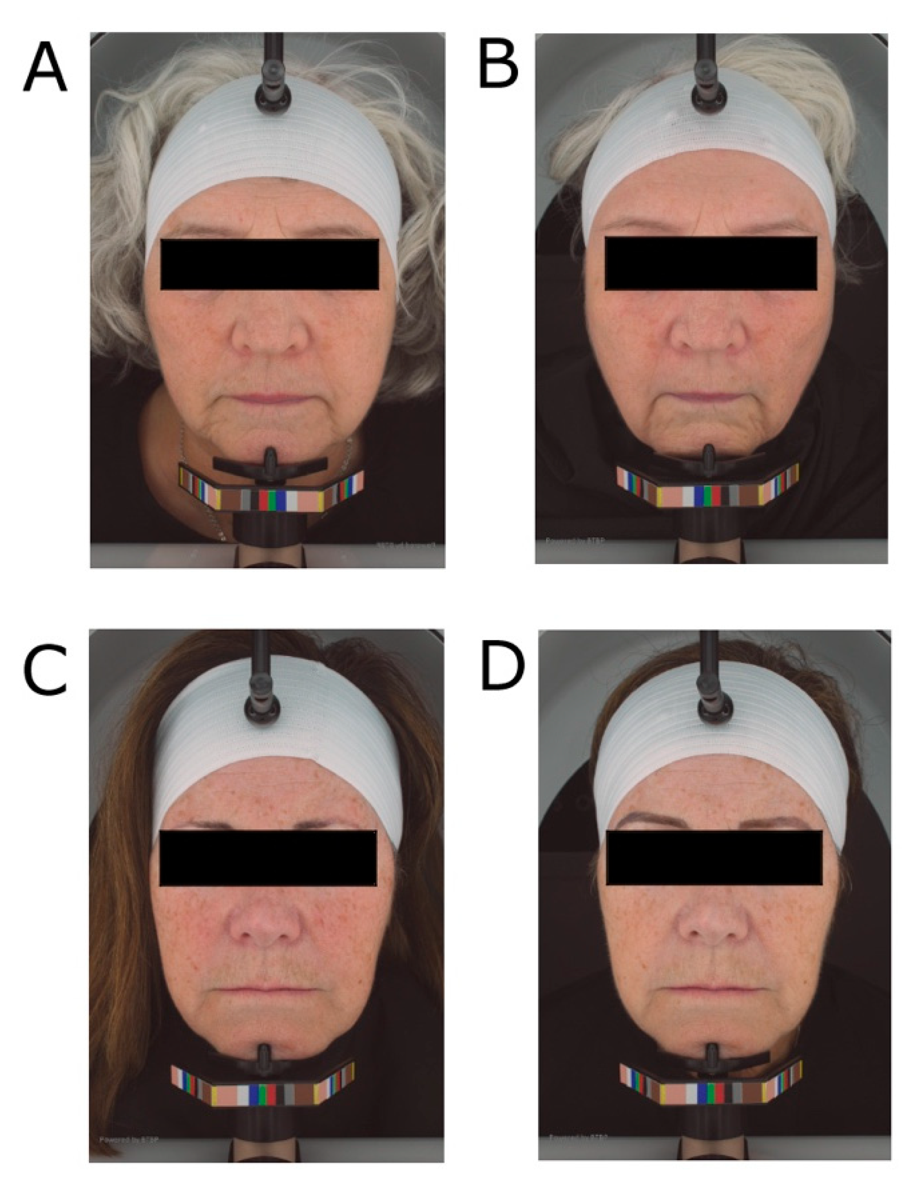 Nutrients 15 04113 g006