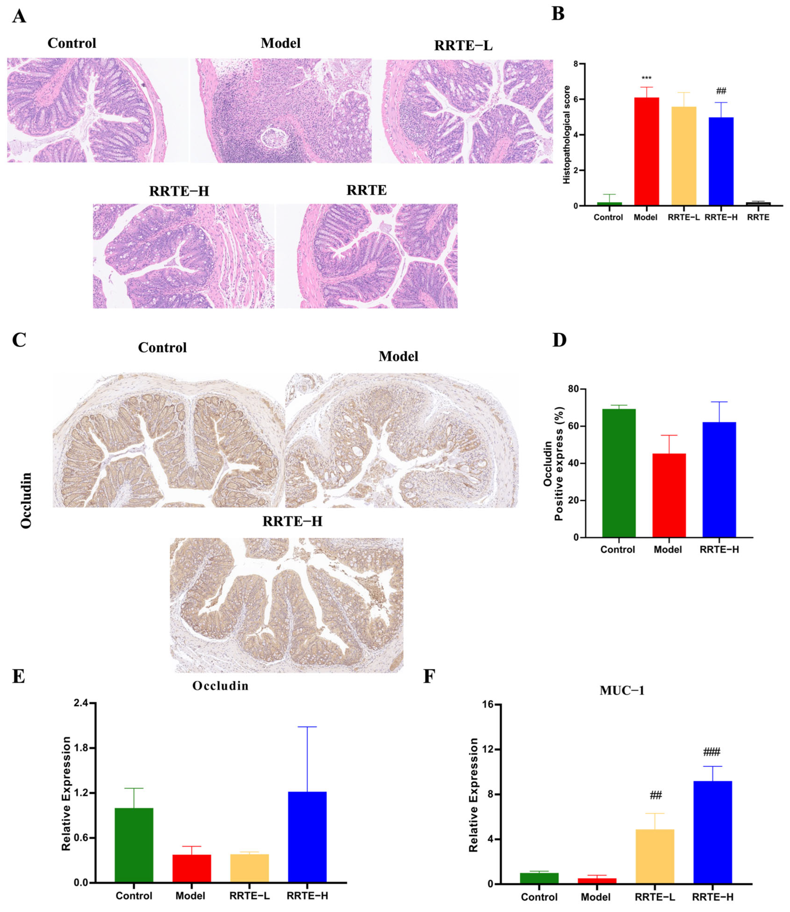 Nutrients 15 04560 g003 Nutrients 15 04560 g003