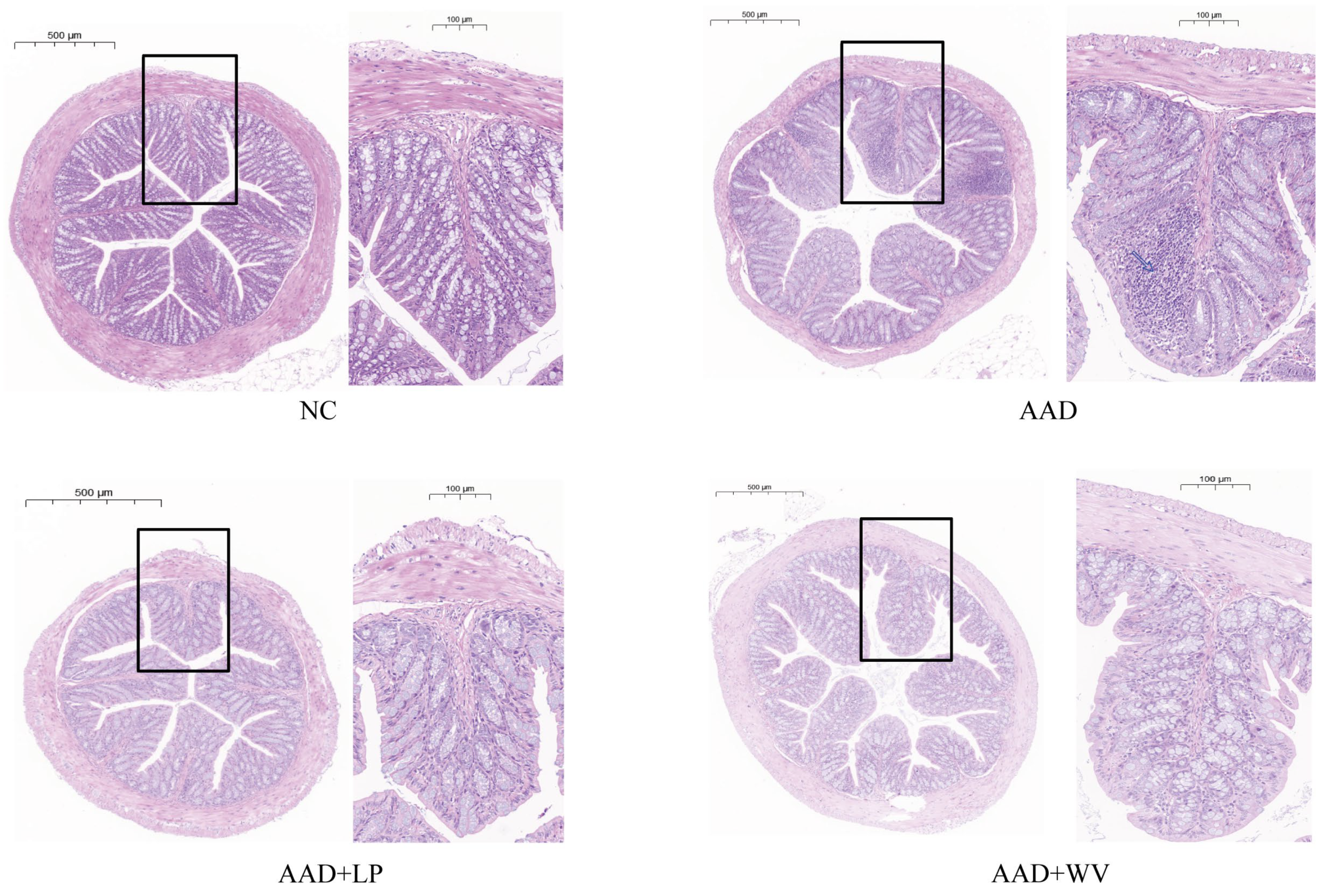 Nutrients 15 04603 g002