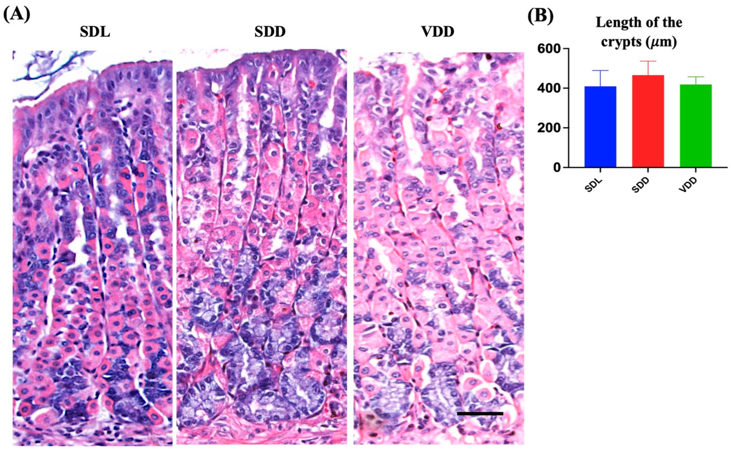 Nutrients 15 04648 g003 Nutrients 15 04648 g003