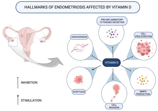How Can Selected Dietary Ingredients Influence the Development and Progression of Endometriosis? How Can Selected Dietary Ingredients Influence the Development and Progression of Endometriosis?