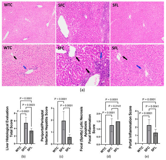 M Probiotic Limosilactobacillus reuteri DSM 17938 Changes Foxp3