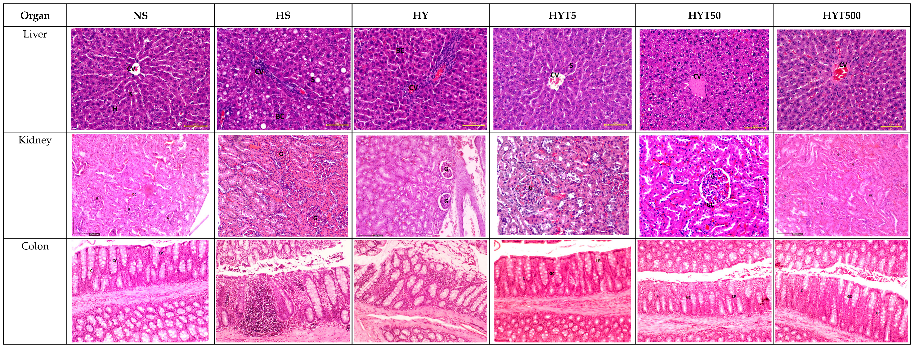 Nutrients 16 01356 g003b