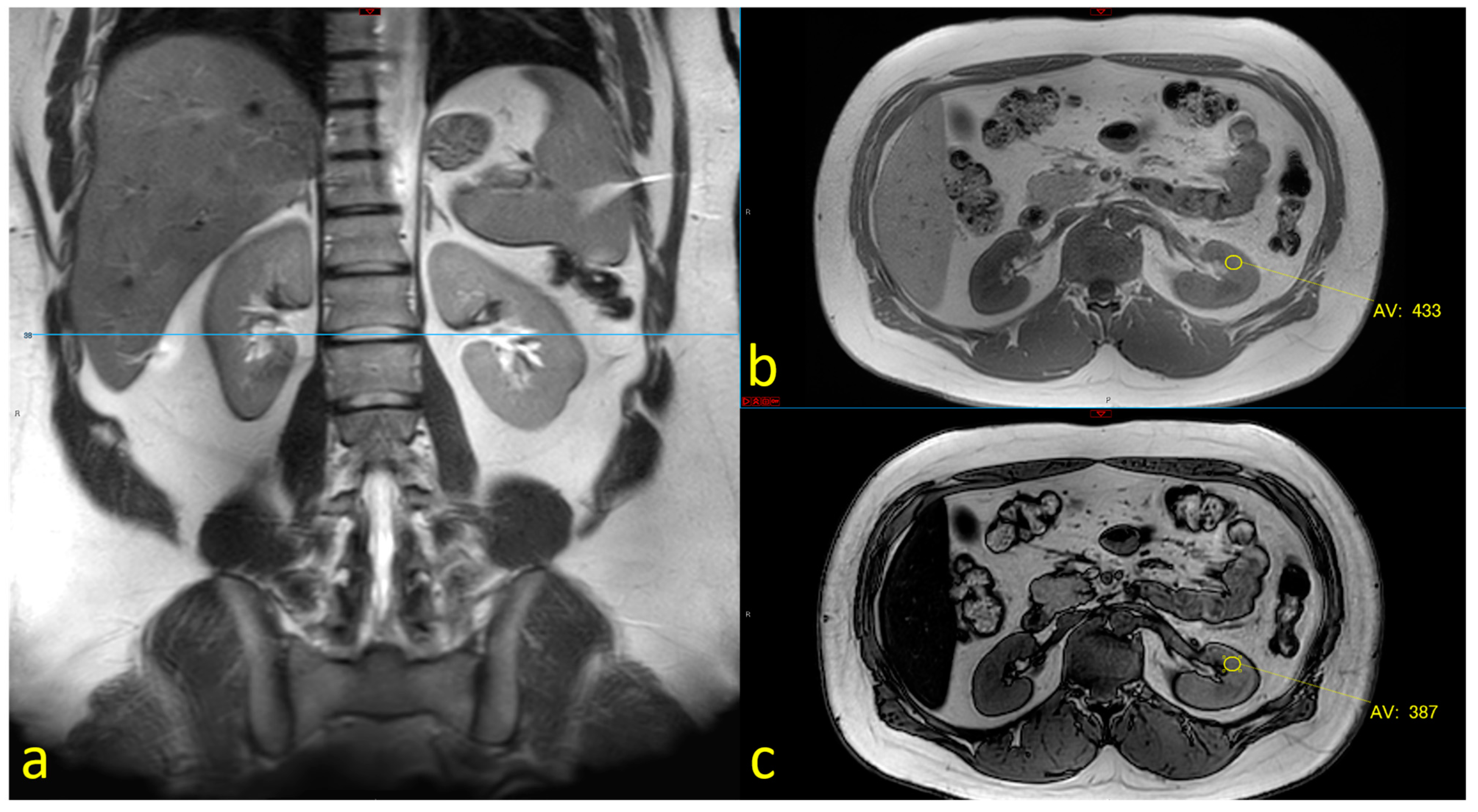 Nutrients 16 01387 g002