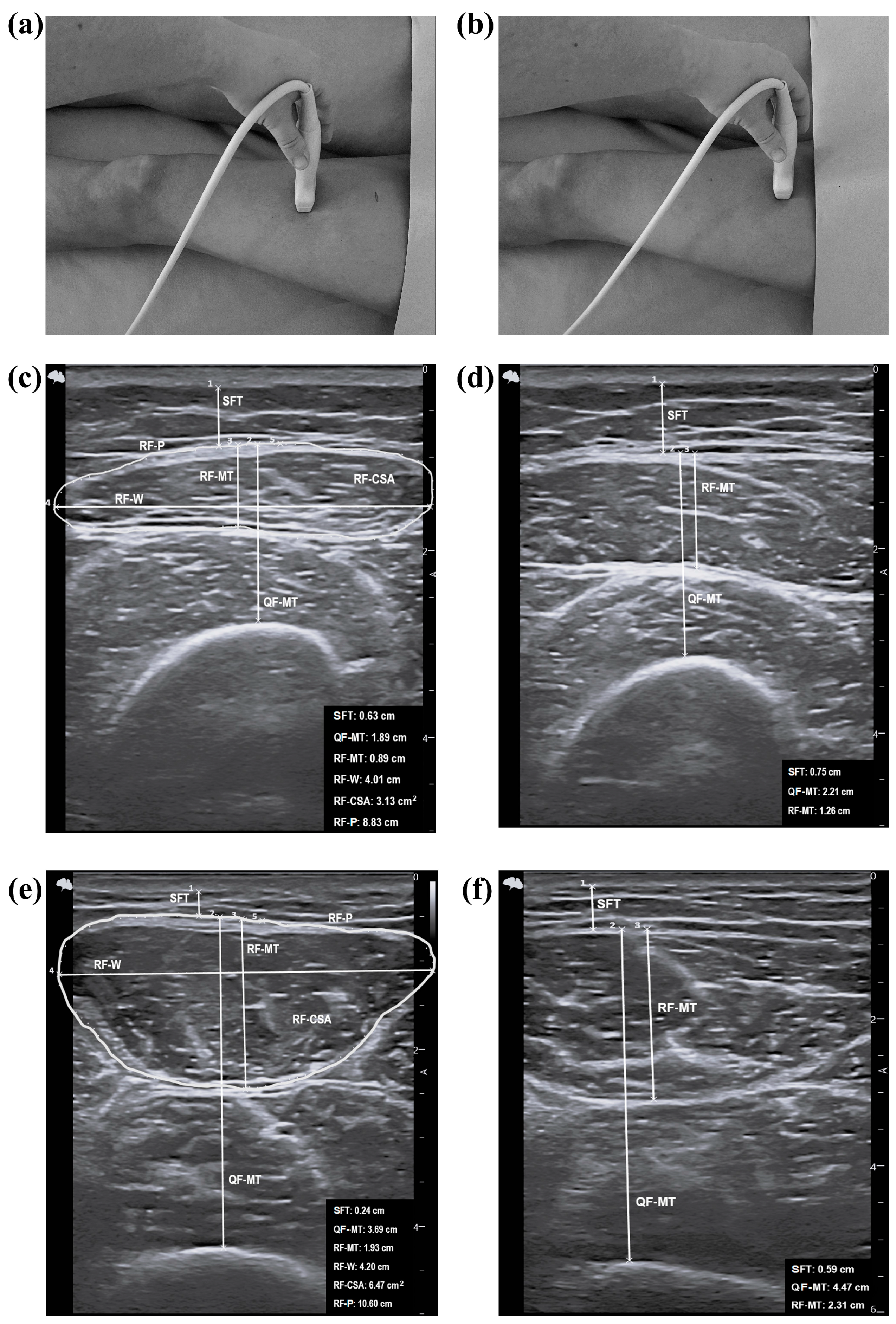 Nutrients 16 01496 g0a1