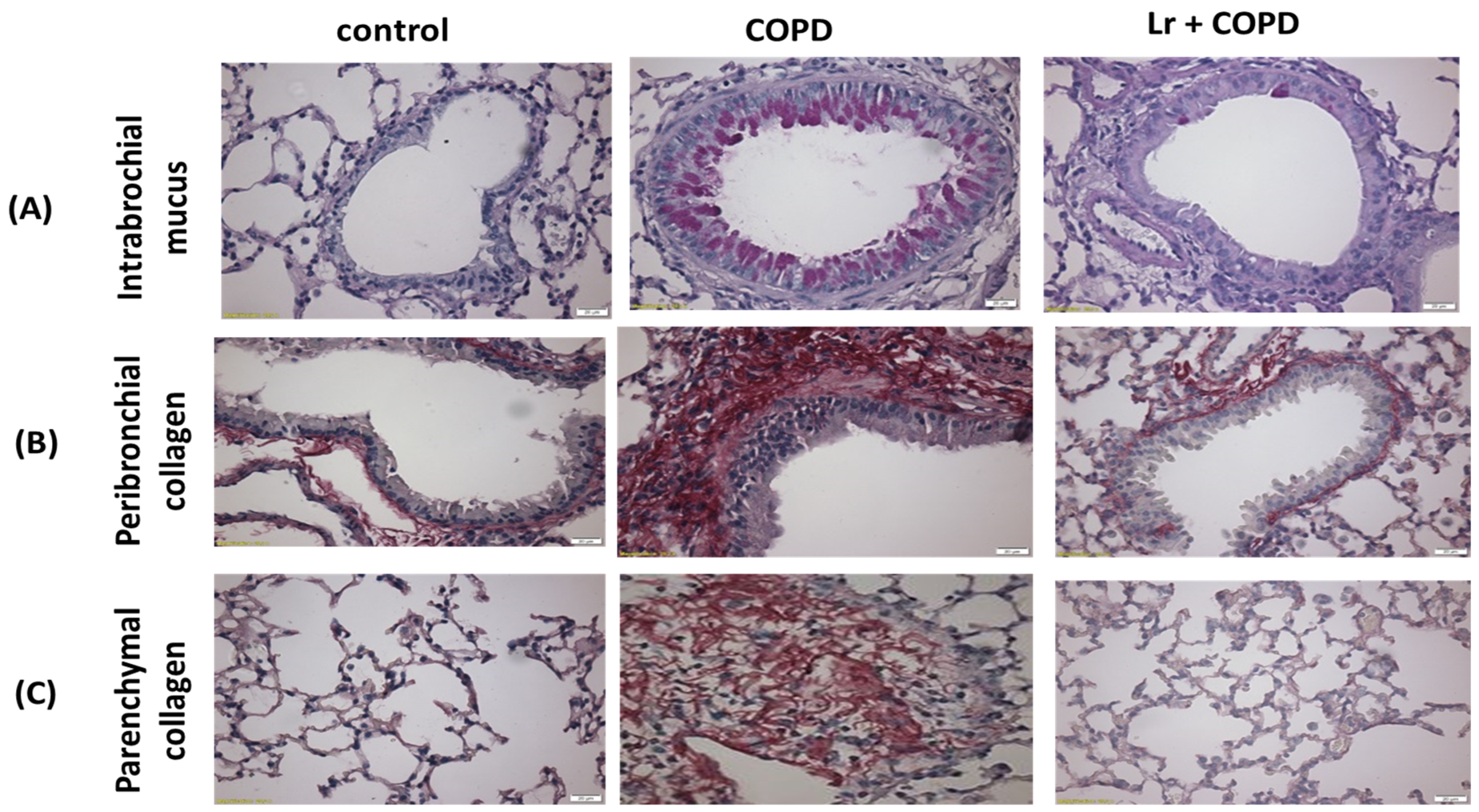 Nutrients 16 01509 g005 Nutrients 16 01509 g005