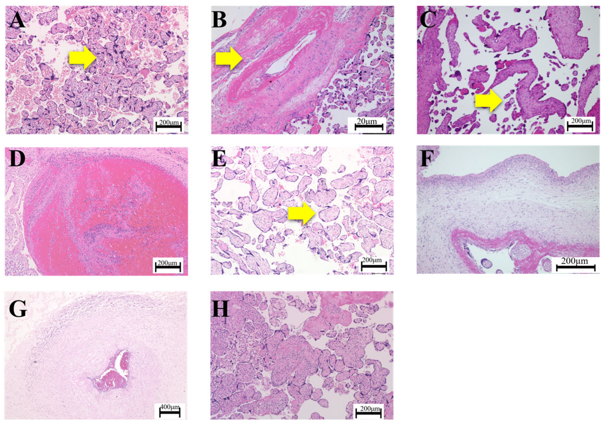 Nutrients 16 01786 g001