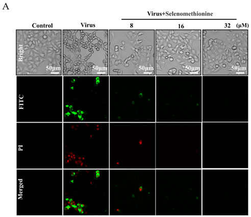 Nutrients 16 02969 i001