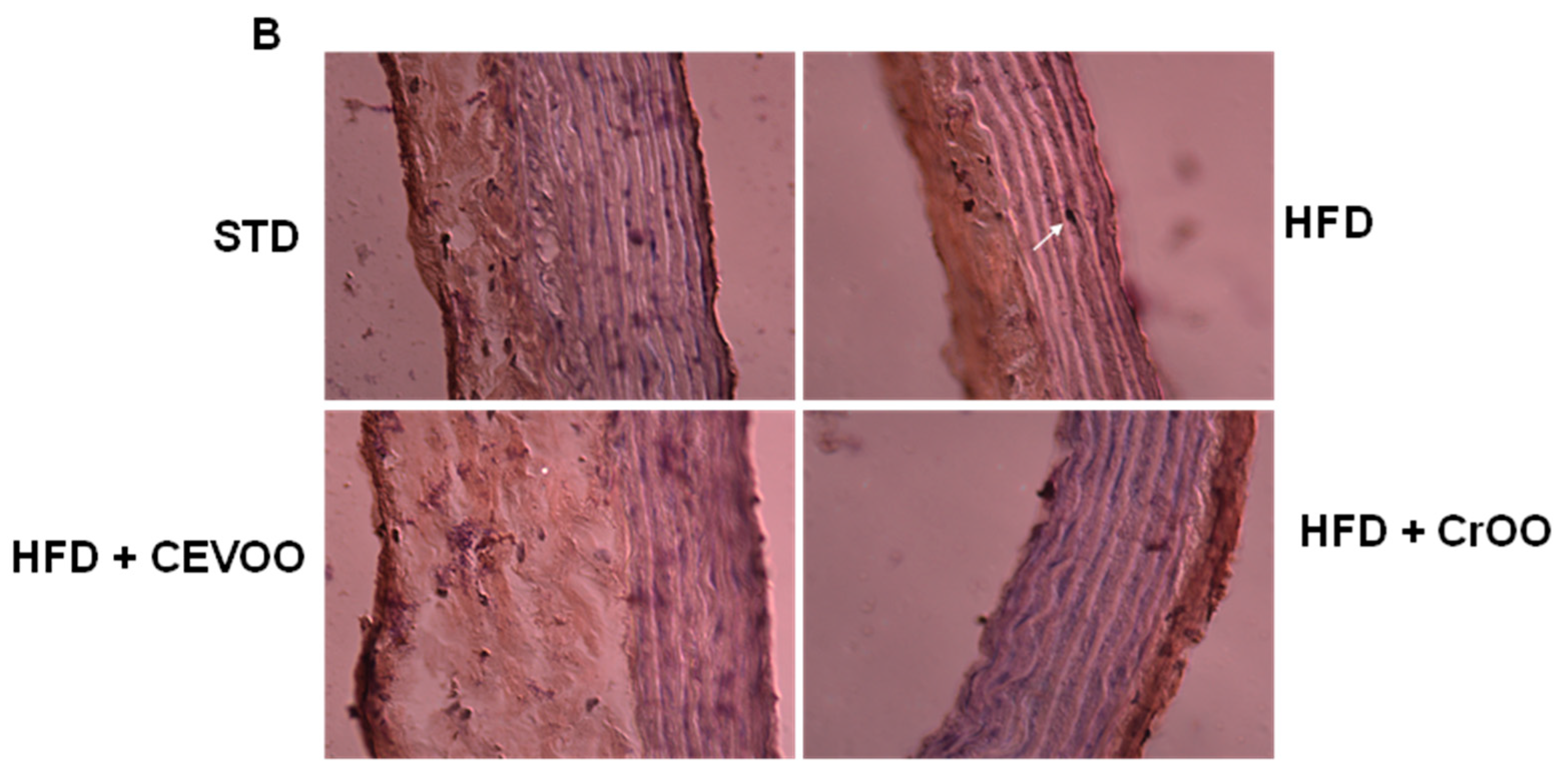 Nutrients 16 03172 g005b