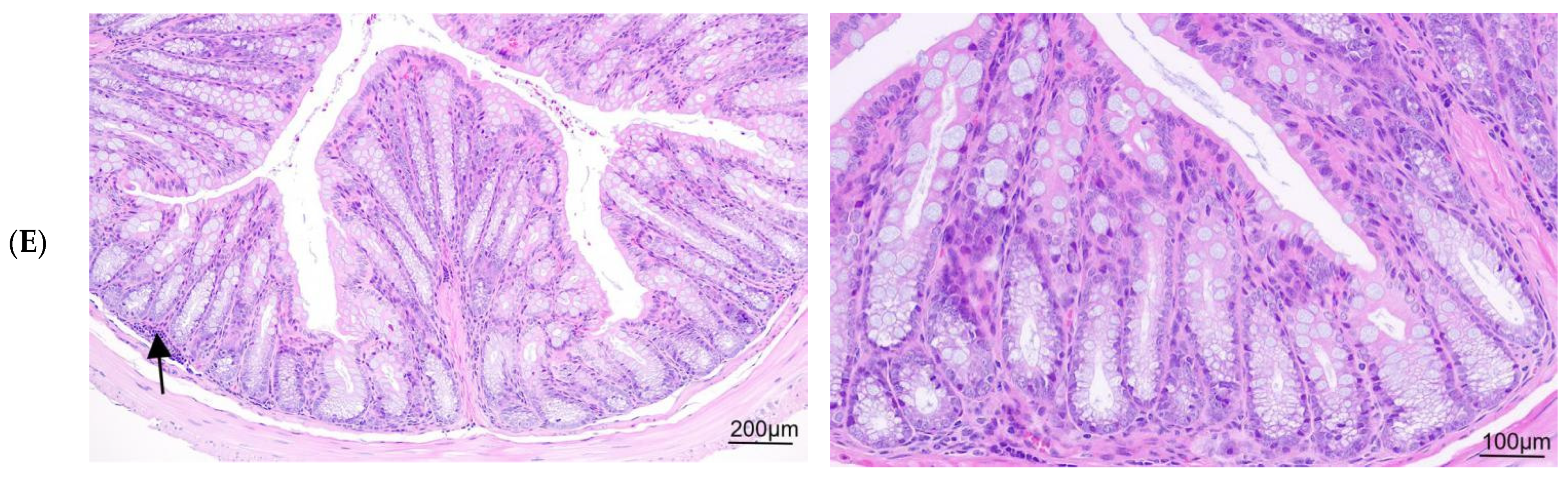 Nutrients 16 03650 g005b