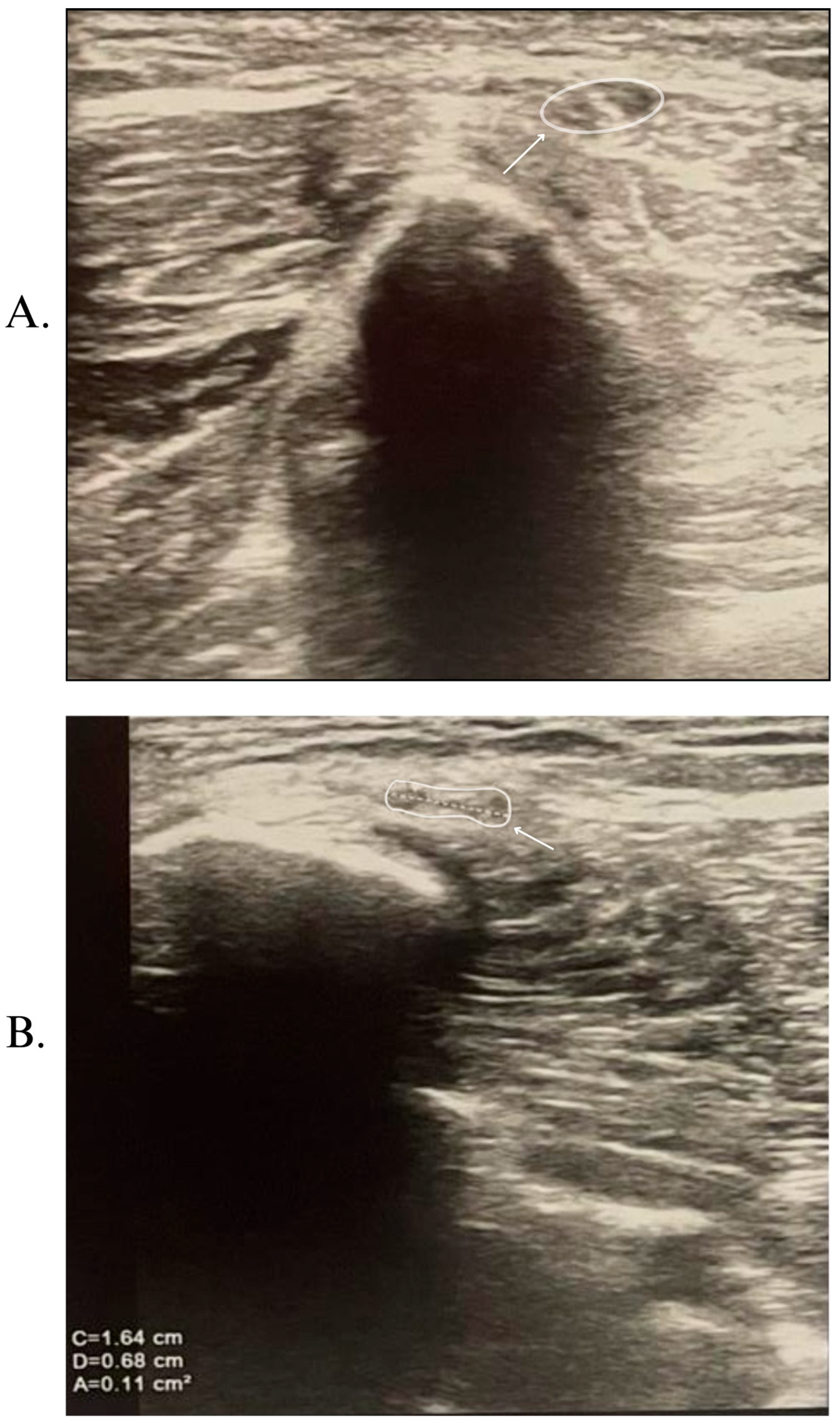 Nutrients 17 01782 g003