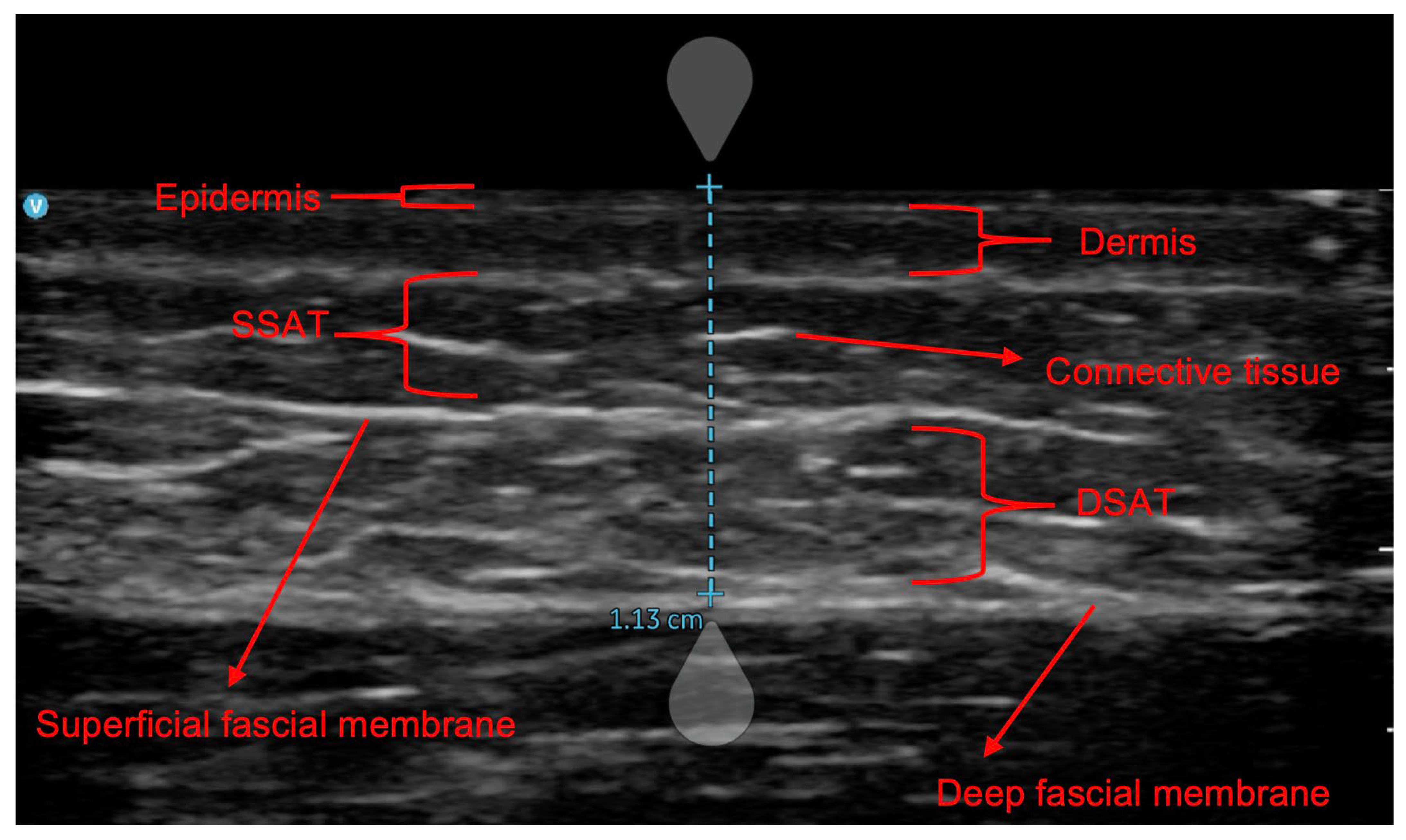 Nutrients 17 01881 g001