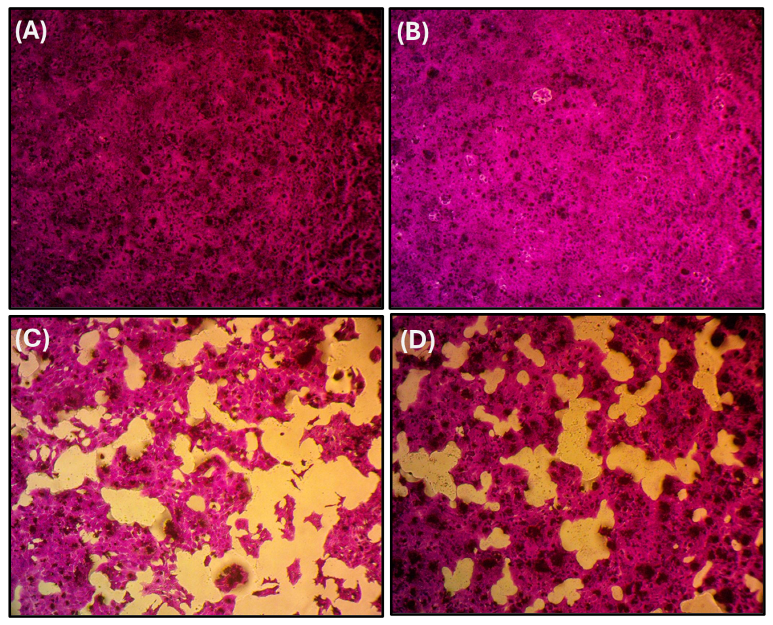 Protective Effect of Biobran/MGN-3, an Arabinoxylan from