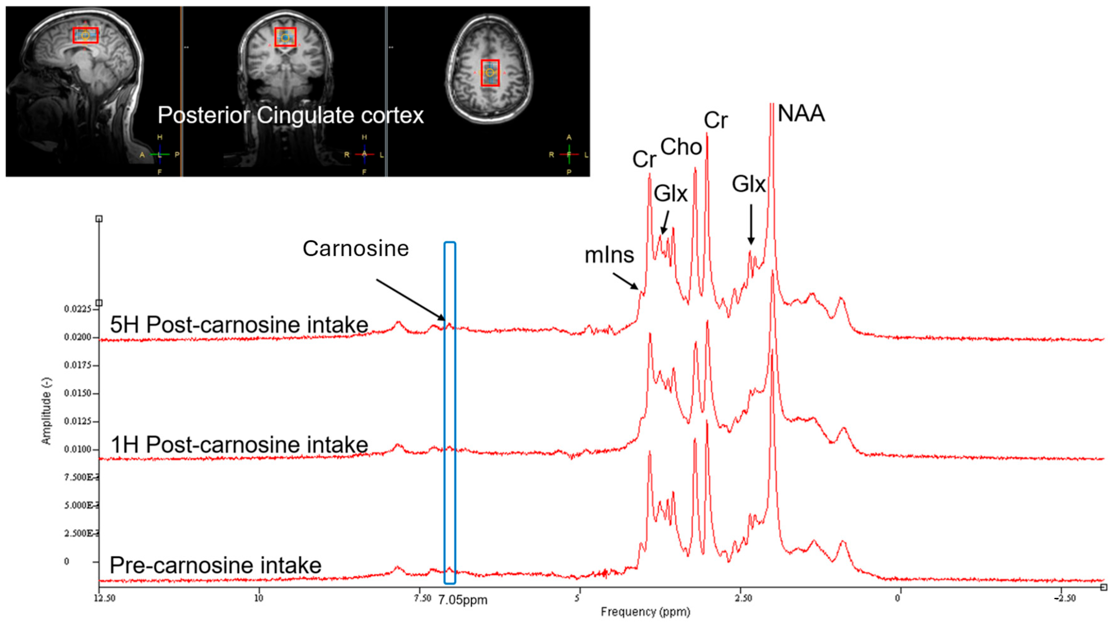 Dietary Carnosine Supplementation in Healthy Human