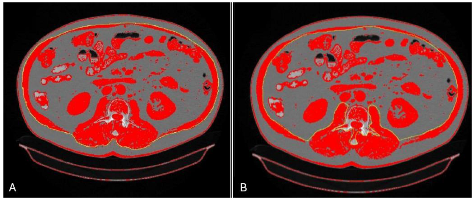 Nutrients 17 02589 g001 Nutrients 17 02589 g001
