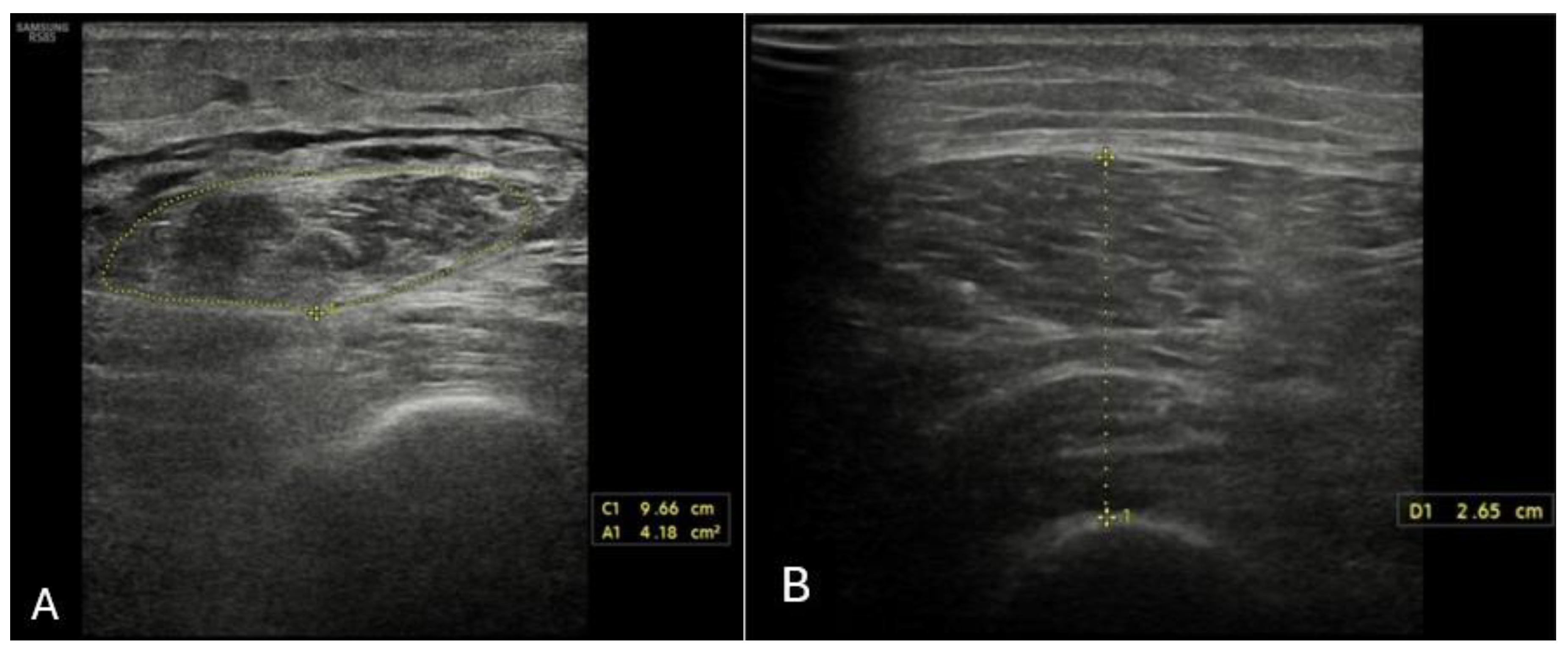 Nutrients 17 02589 g003 Nutrients 17 02589 g003
