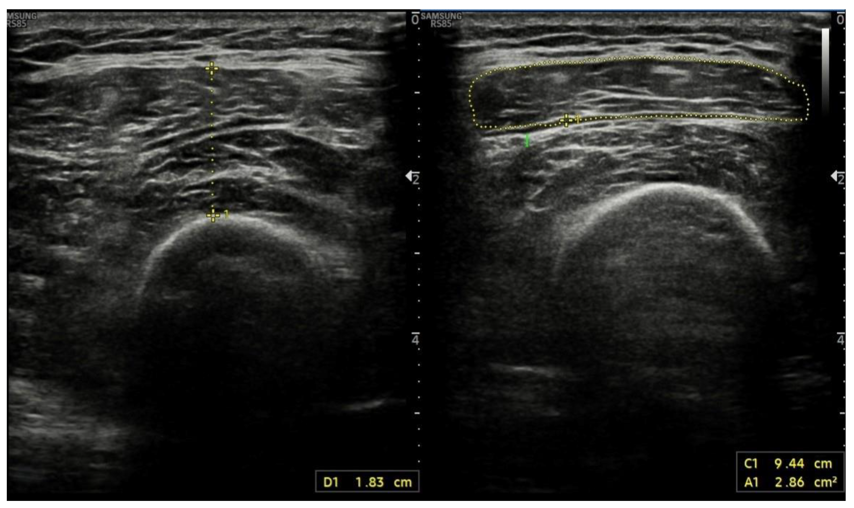 Nutrients 17 02589 g004 Nutrients 17 02589 g004