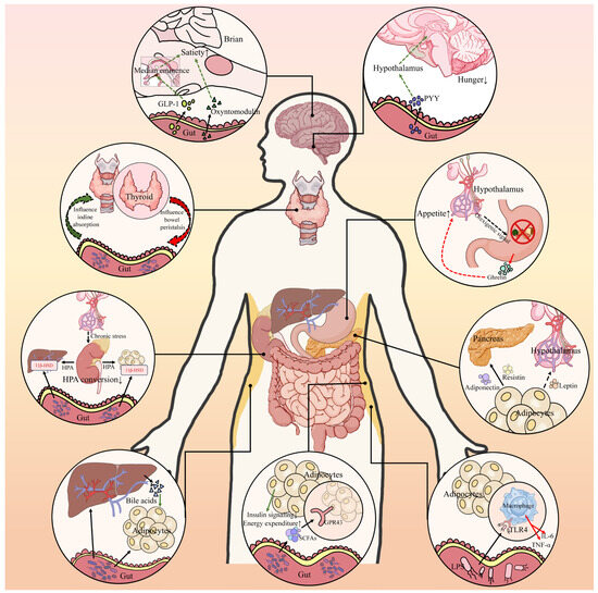 Type 2 Diabetes and the Multifaceted Gut-X Axes
