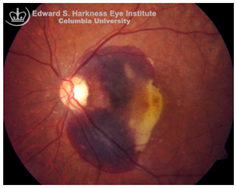 Nutrients 17 02964 i006